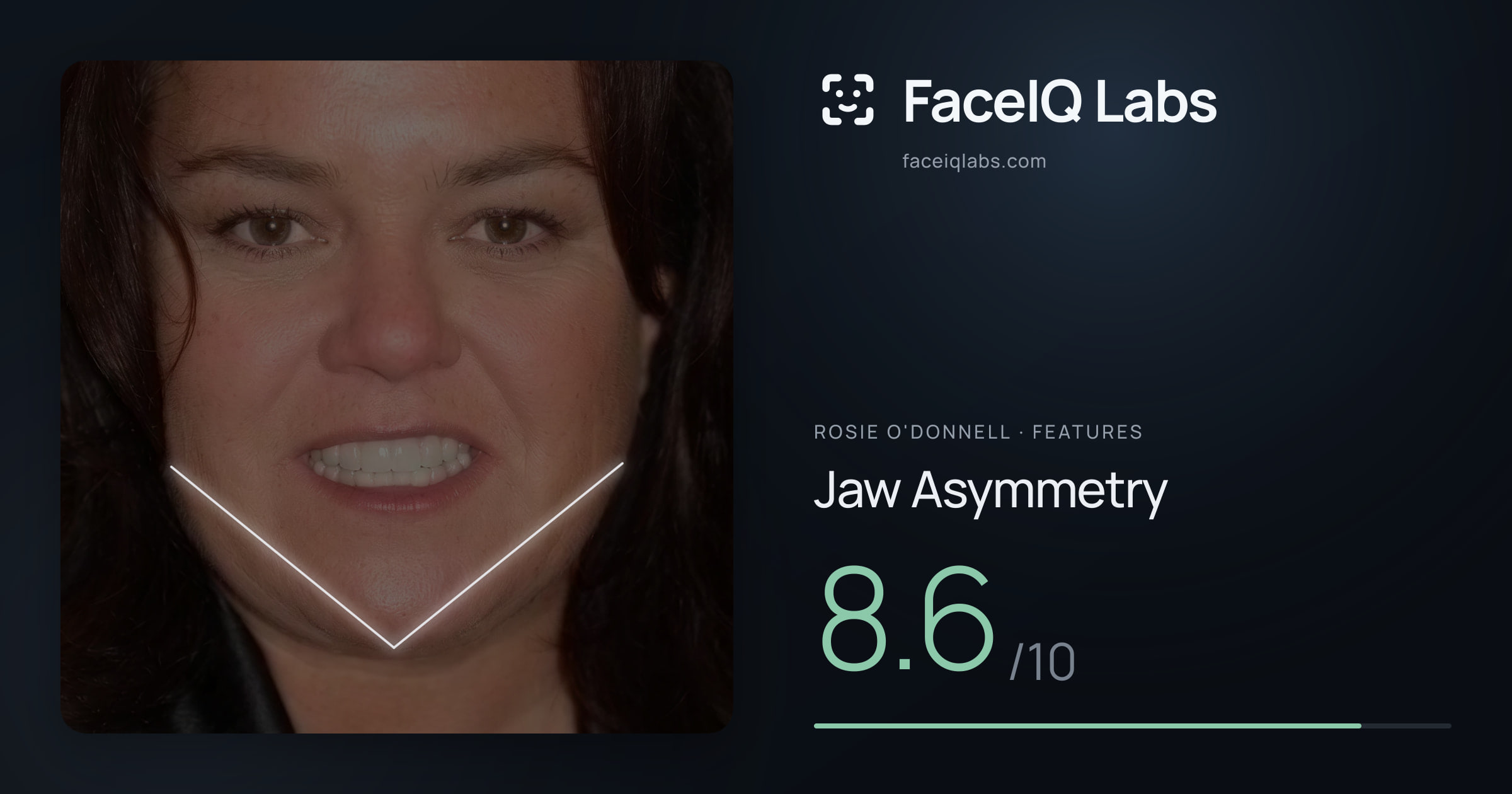 Rosie O'Donnell Jaw Asymmetry: 8.6/10, drawn on the photo