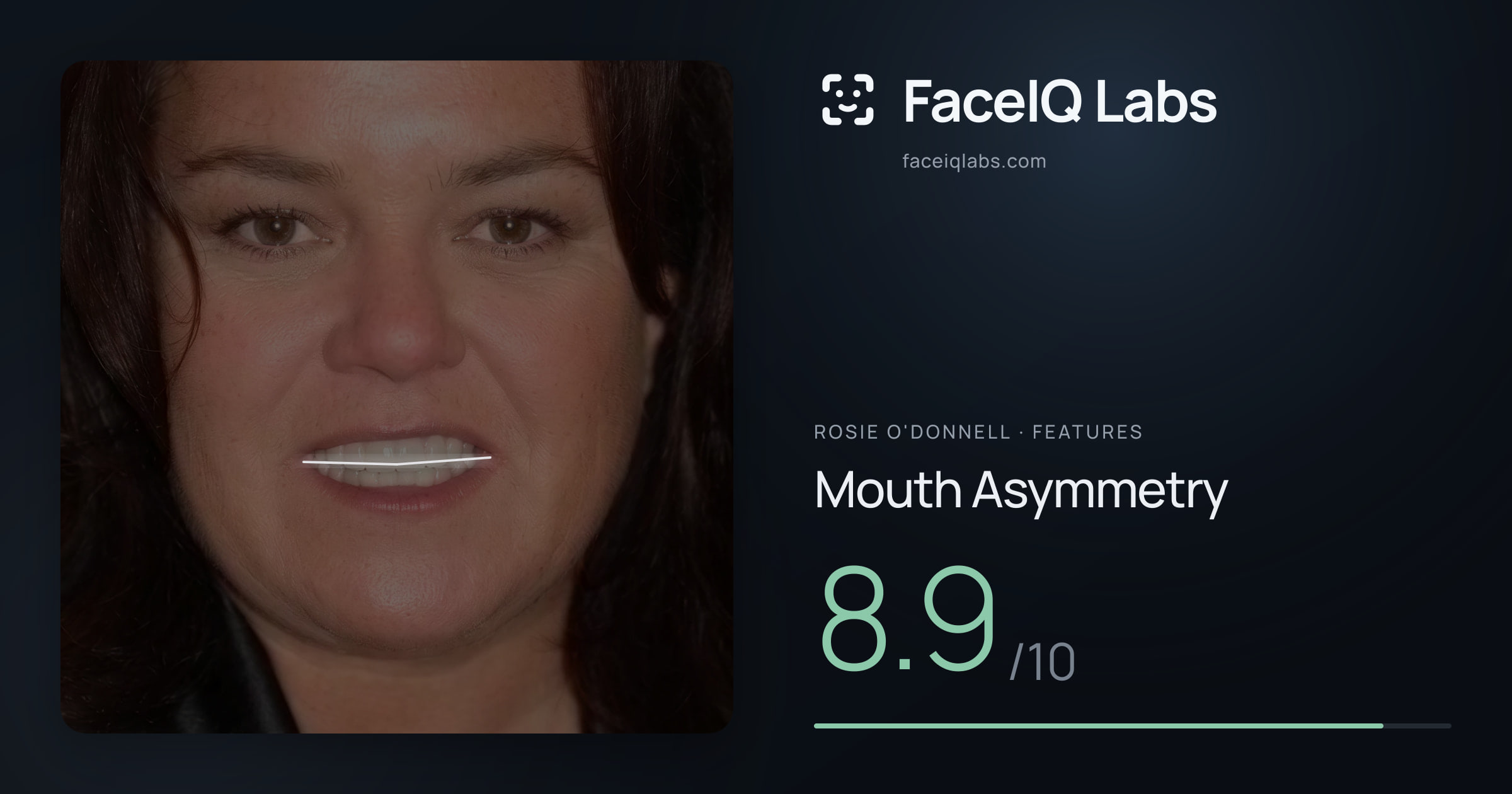 Rosie O'Donnell Mouth Asymmetry: 8.9/10, drawn on the photo
