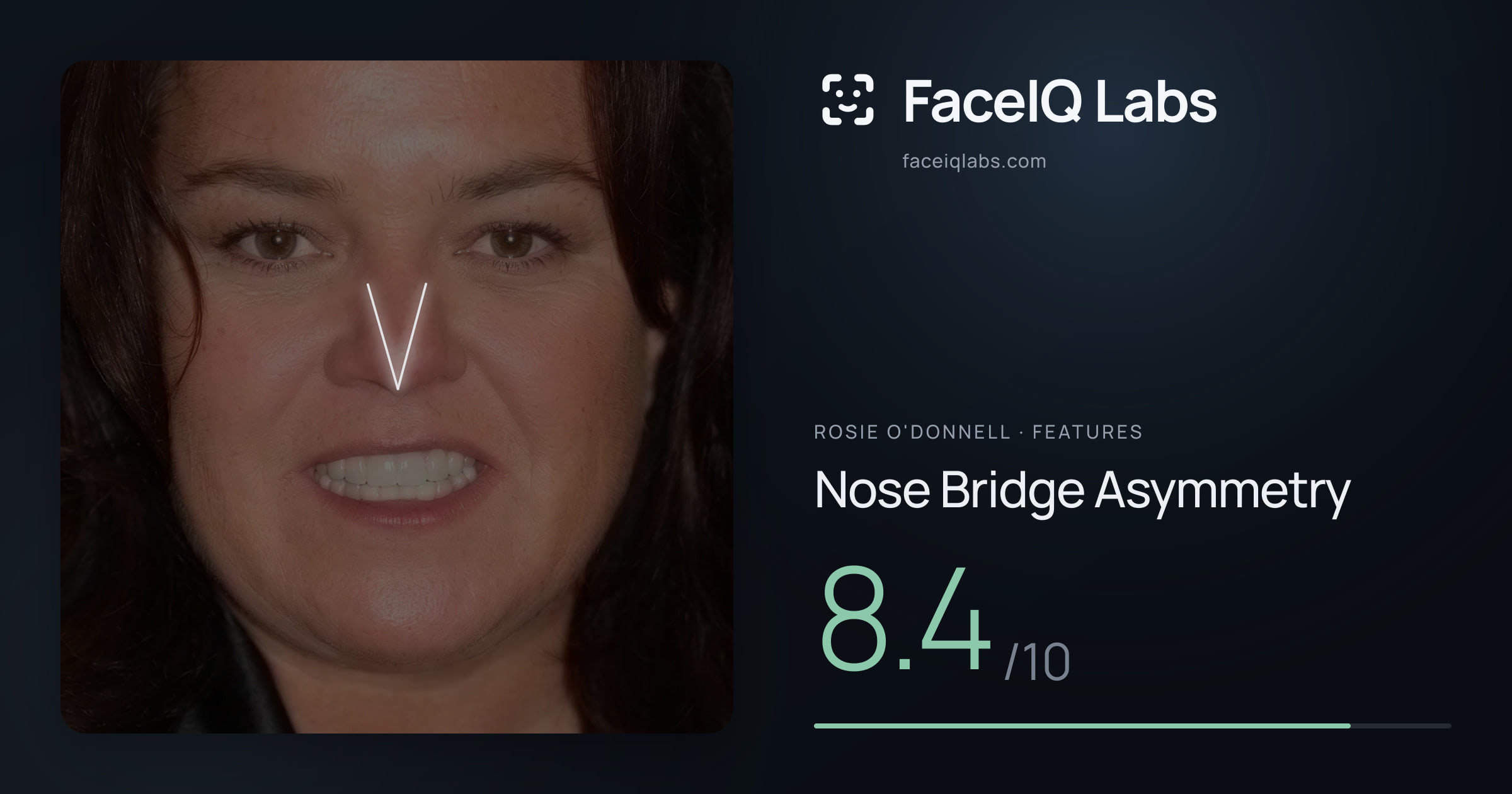 Rosie O'Donnell Nose Bridge Asymmetry: 8.4/10, drawn on the photo