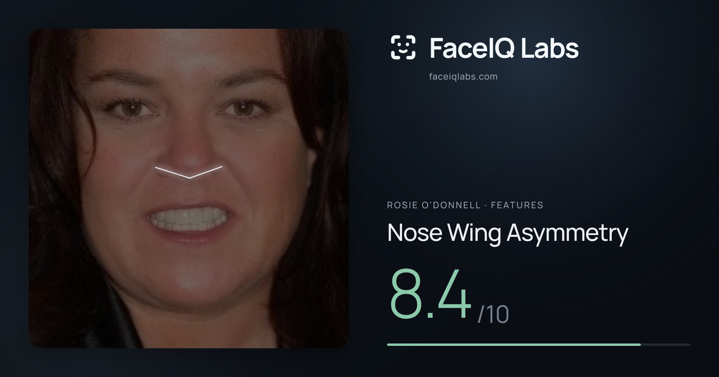 Rosie O'Donnell Nose Wing Asymmetry: 8.4/10, drawn on the photo
