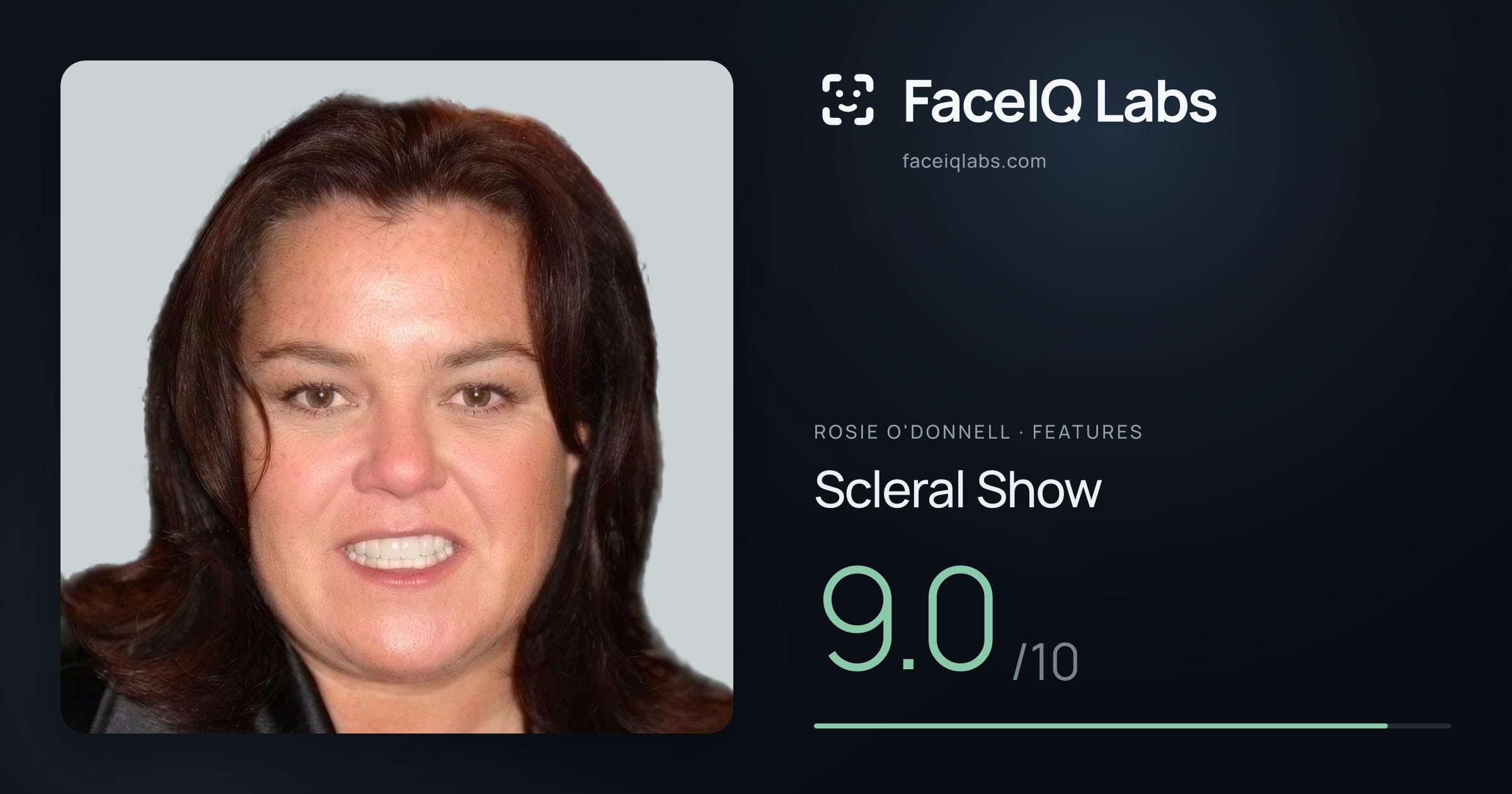 Rosie O'Donnell Scleral Show: 9.0/10, drawn on the photo