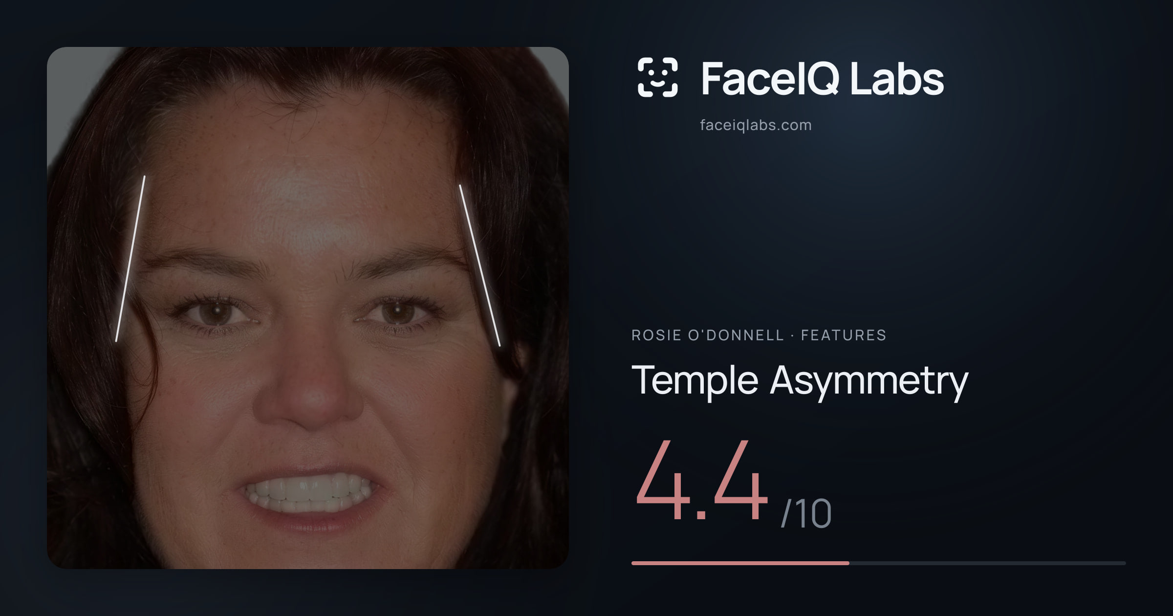 Rosie O'Donnell Temple Asymmetry: 4.4/10, drawn on the photo