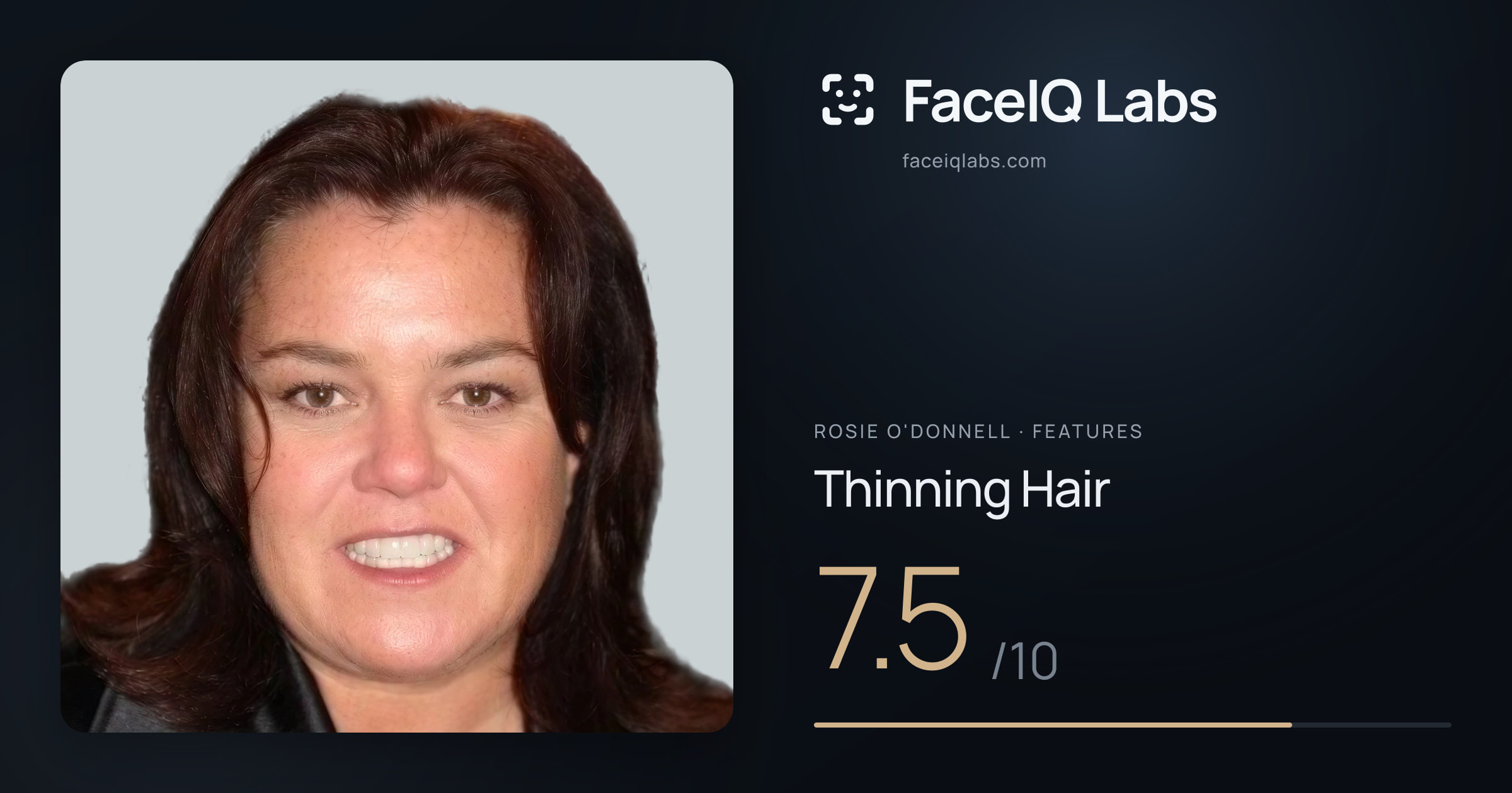 Rosie O'Donnell Thinning Hair: 7.5/10, drawn on the photo