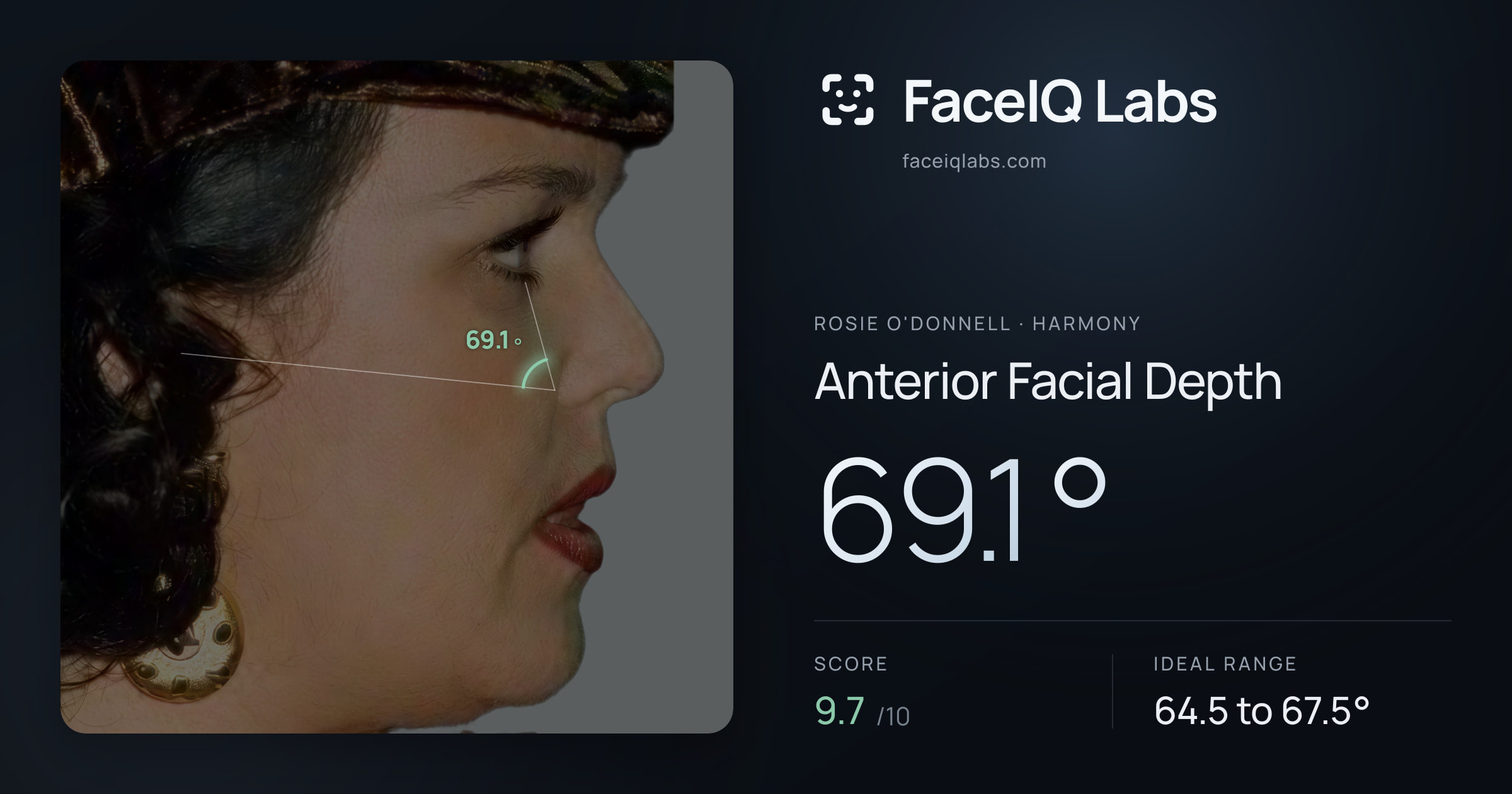 Rosie O'Donnell Anterior Facial Depth: 69.1°, drawn on the photo