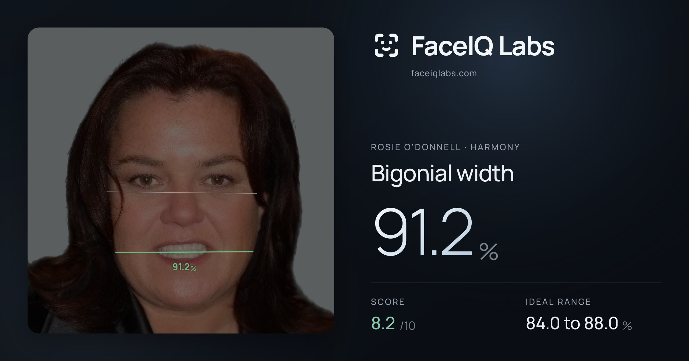Rosie O'Donnell Bigonial width: 91.2%, drawn on the photo