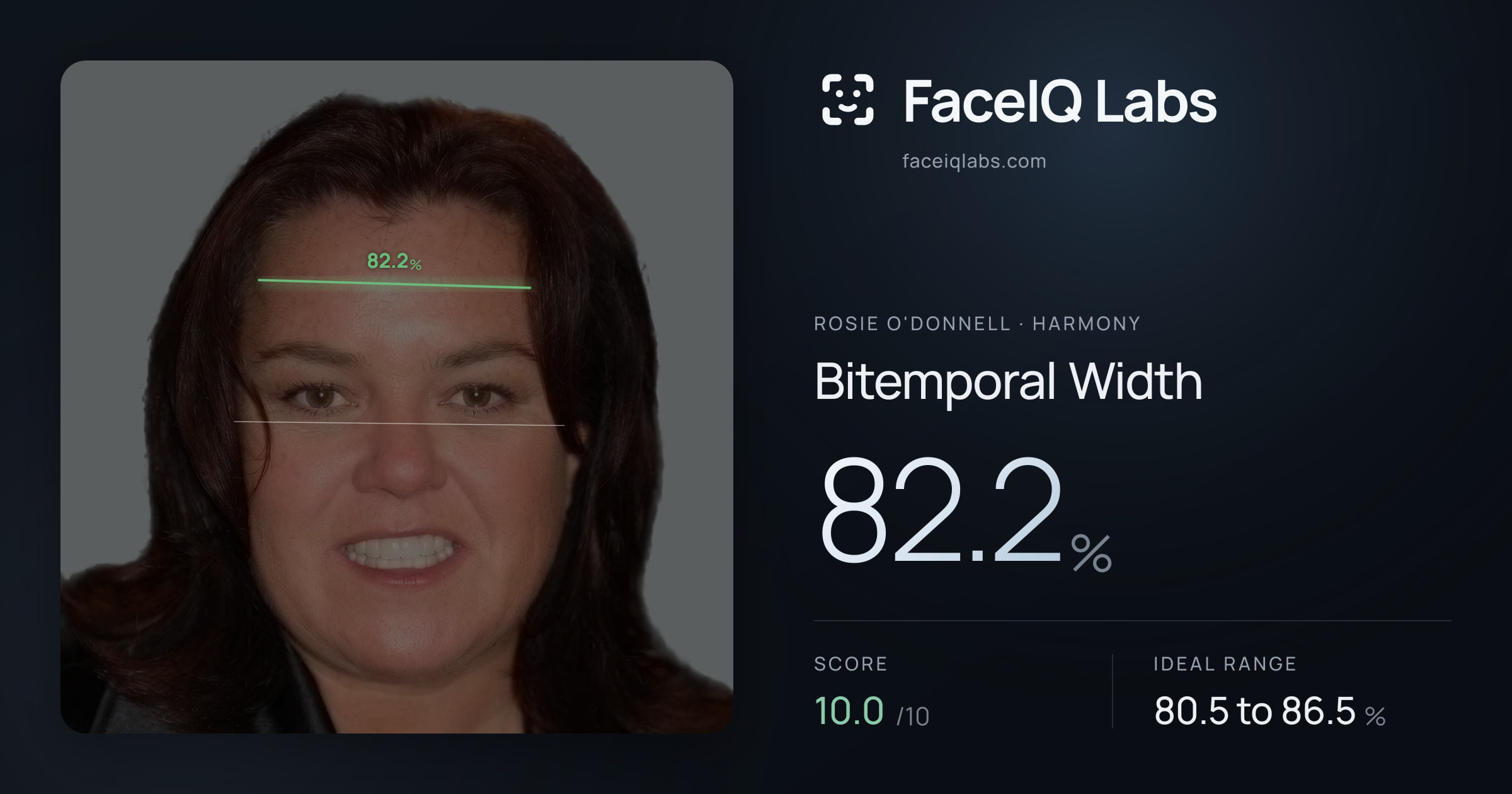Rosie O'Donnell Bitemporal Width: 82.2%, drawn on the photo