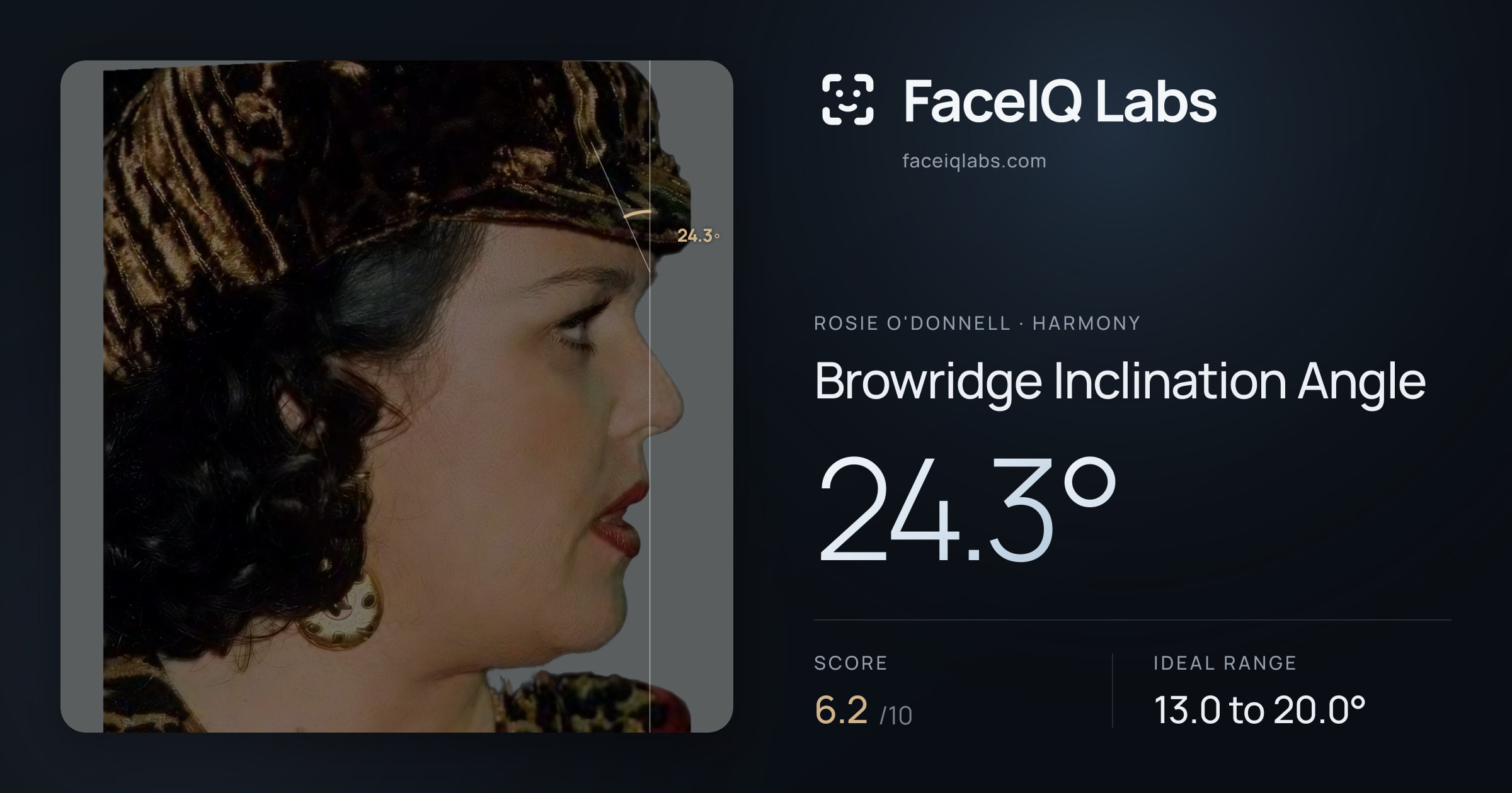 Rosie O'Donnell Browridge Inclination Angle: 24.3°, drawn on the photo