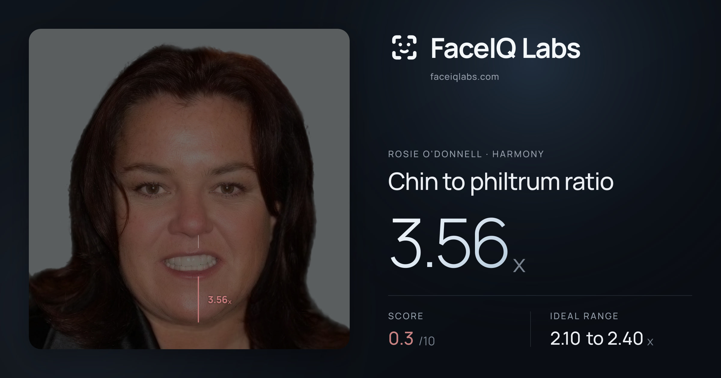 Rosie O'Donnell Chin to philtrum ratio: 3.56x, drawn on the photo