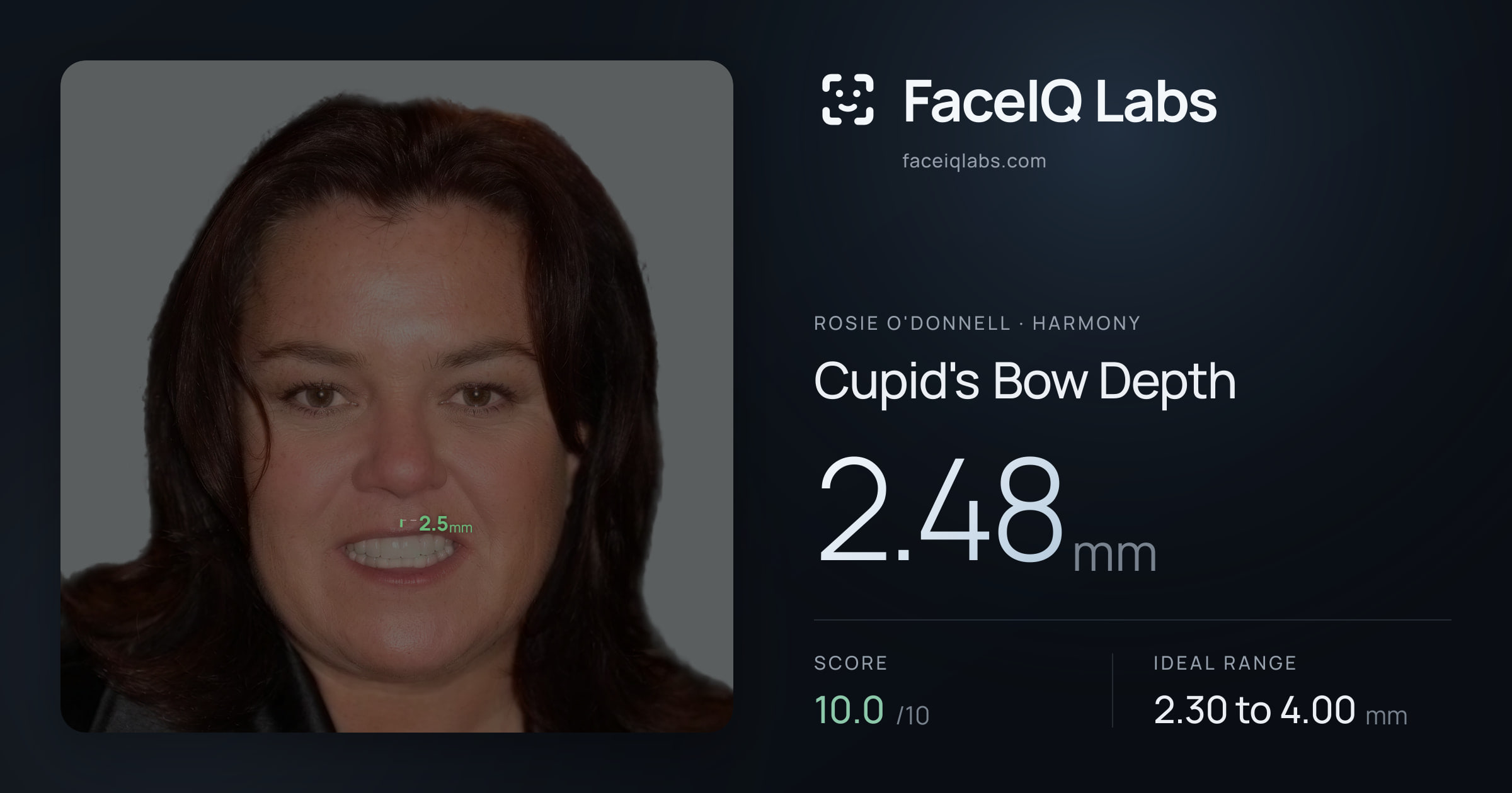 Rosie O'Donnell Cupid's Bow Depth: 2.48mm, drawn on the photo