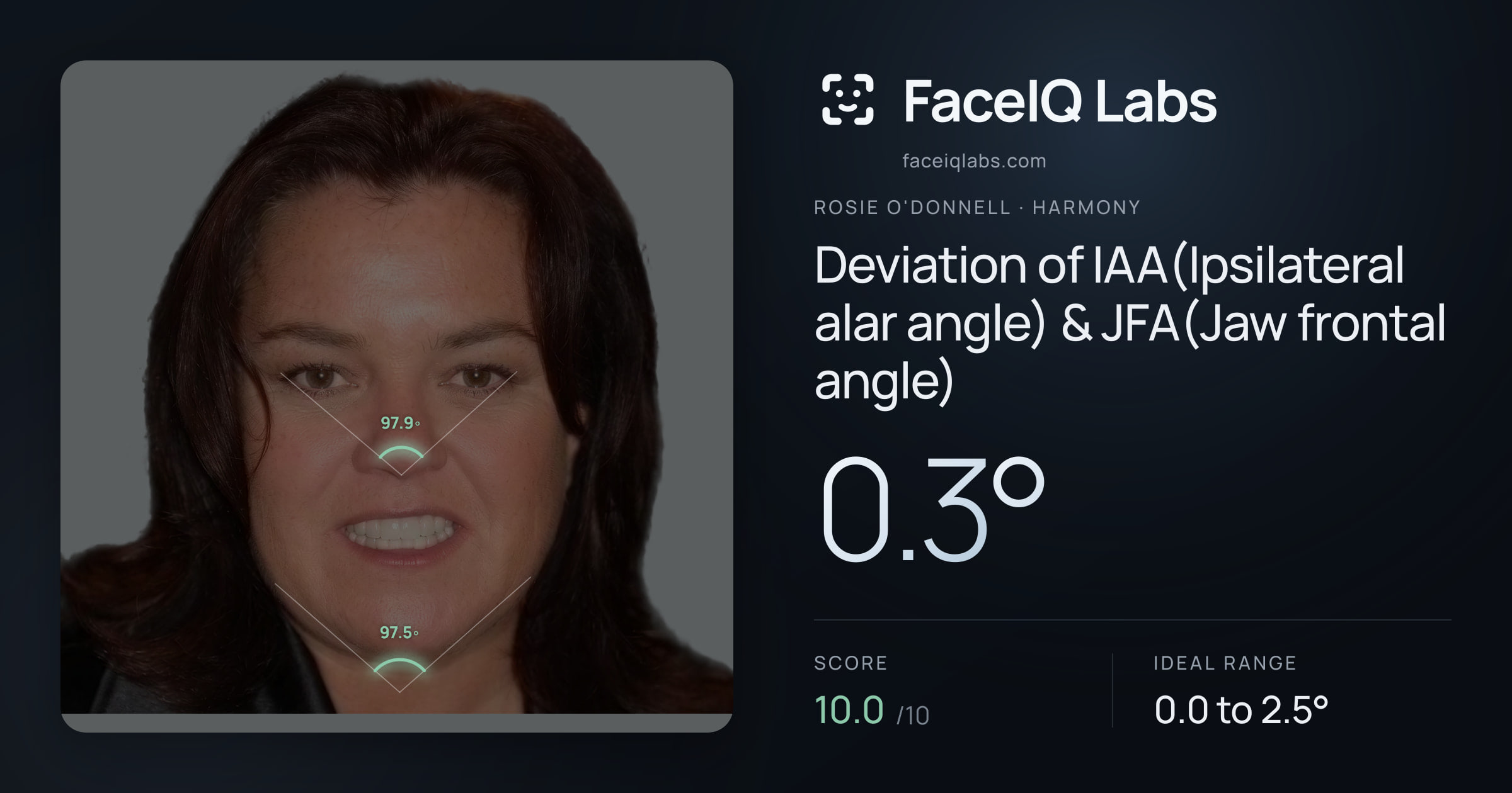 Rosie O'Donnell Deviation of IAA(Ipsilateral alar angle) & JFA(Jaw frontal angle): 0.3°, drawn on the photo