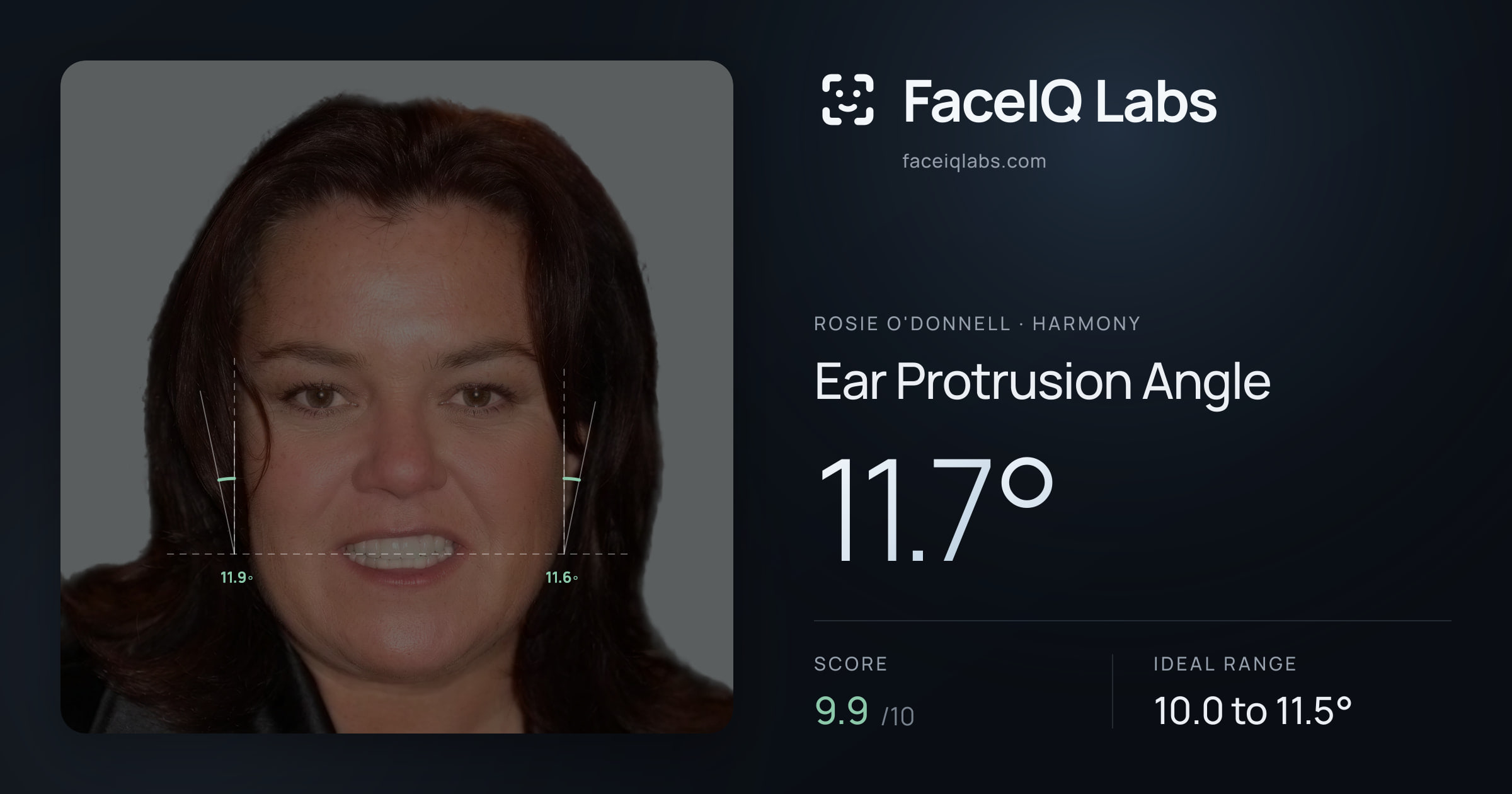 Rosie O'Donnell Ear Protrusion Angle: 11.7°, drawn on the photo