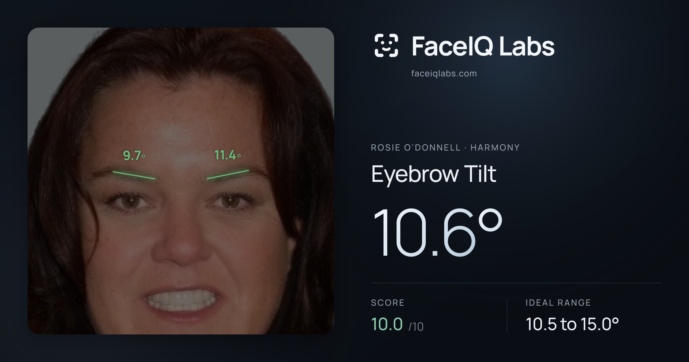 Rosie O'Donnell Eyebrow Tilt: 10.6°, drawn on the photo