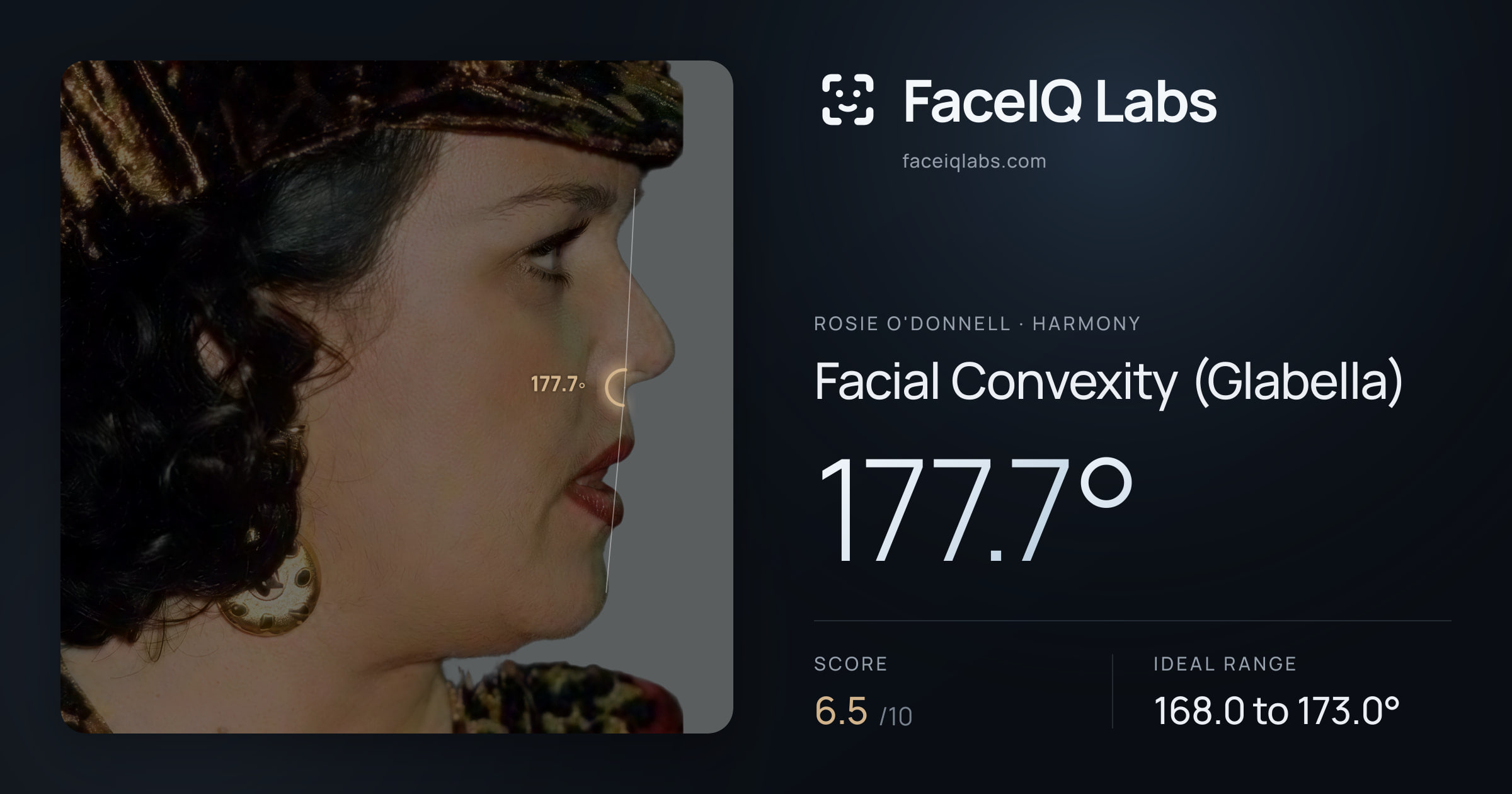 Rosie O'Donnell Facial Convexity (Glabella): 177.7°, drawn on the photo