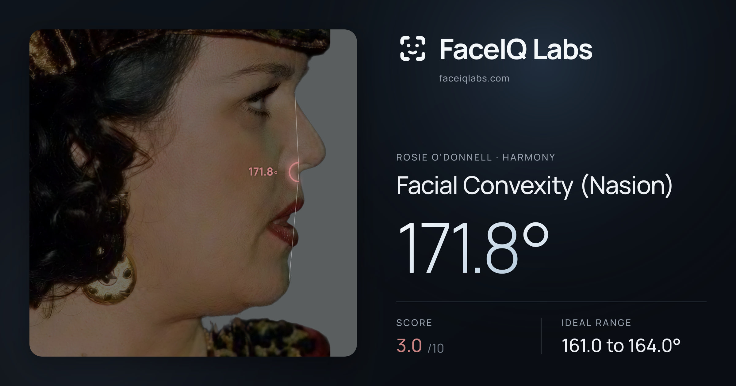 Rosie O'Donnell Facial Convexity (Nasion): 171.8°, drawn on the photo