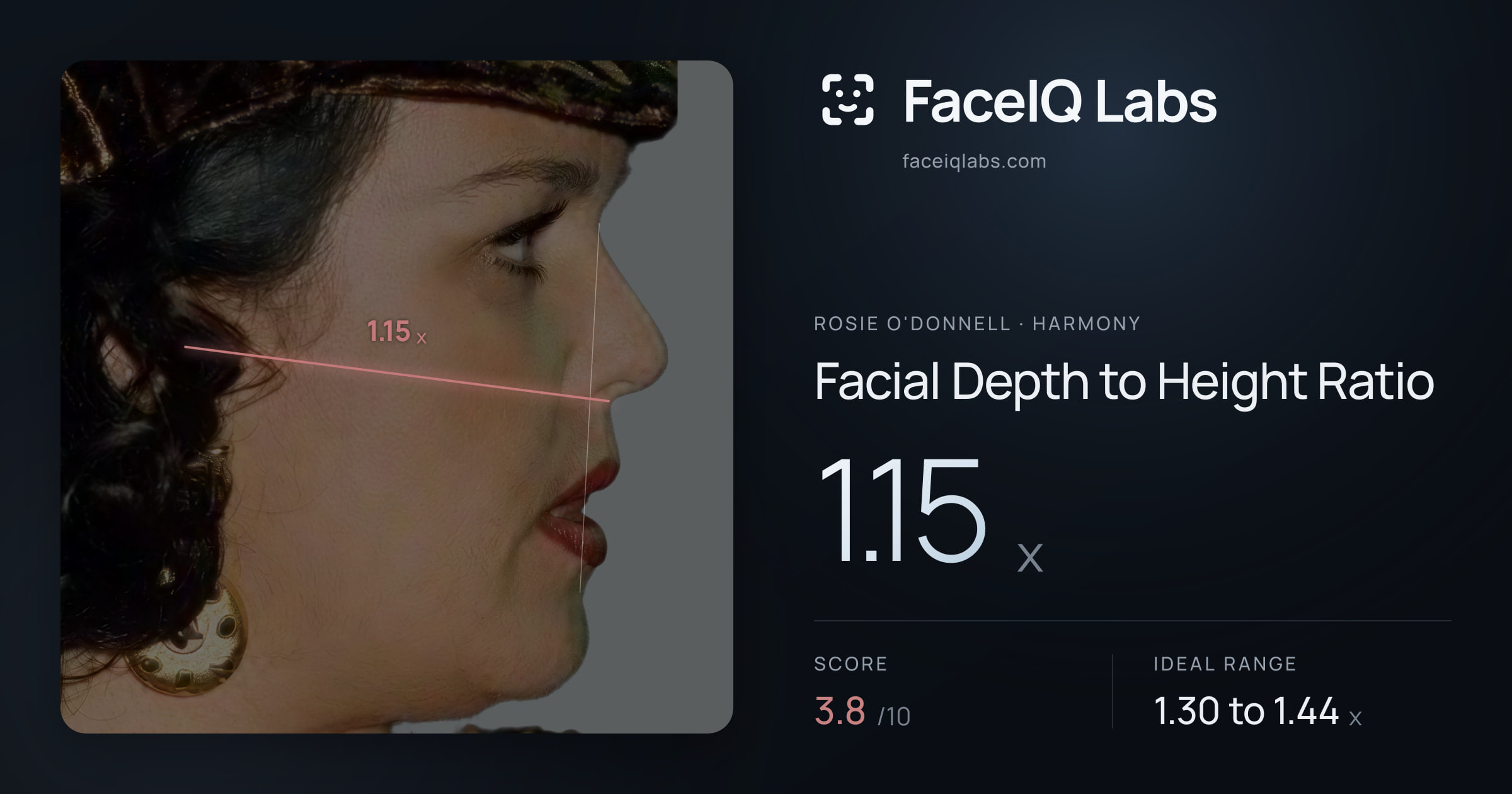 Rosie O'Donnell Facial Depth to Height Ratio: 1.15x, drawn on the photo