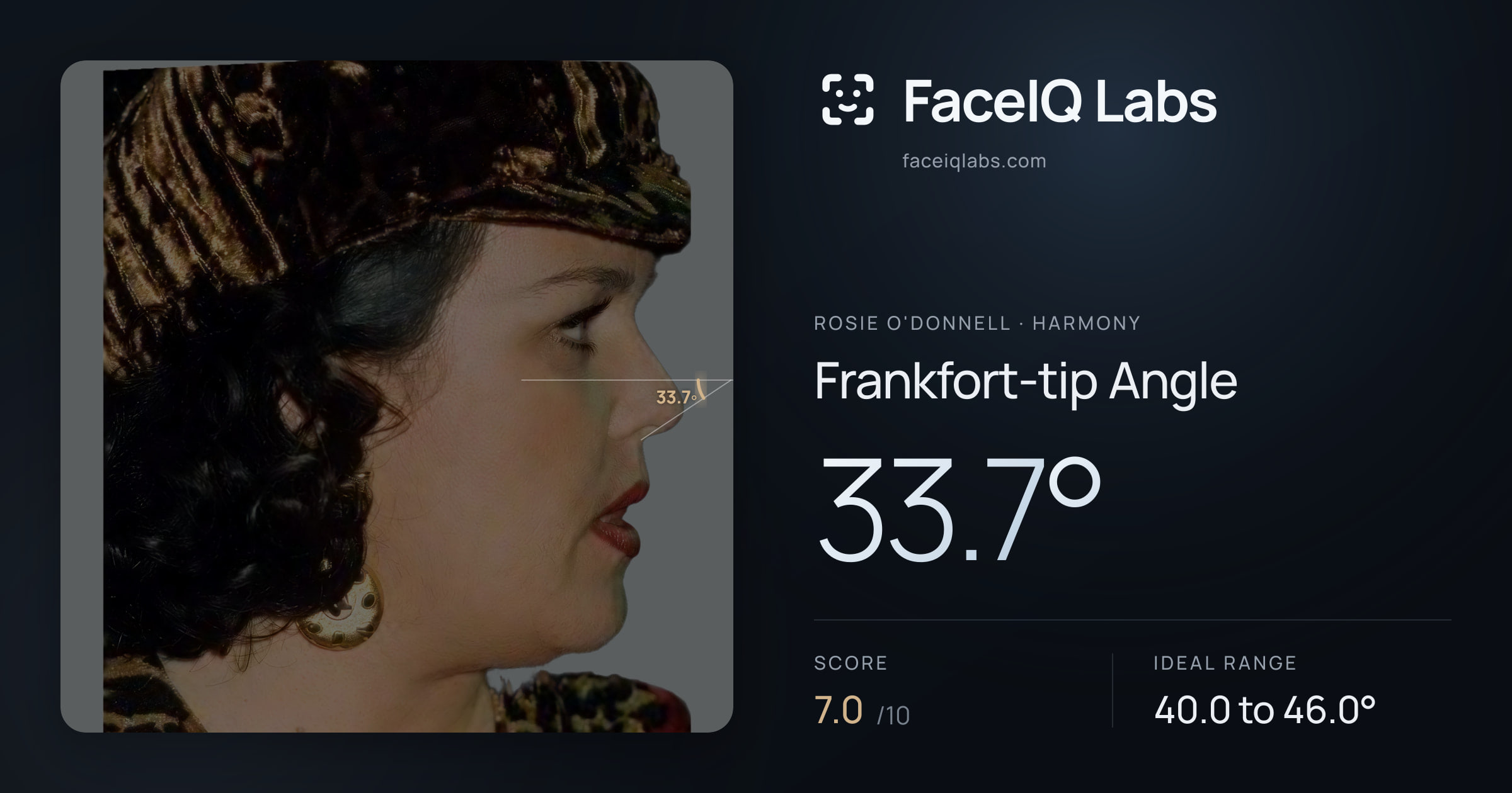 Rosie O'Donnell Frankfort-tip Angle: 33.7°, drawn on the photo