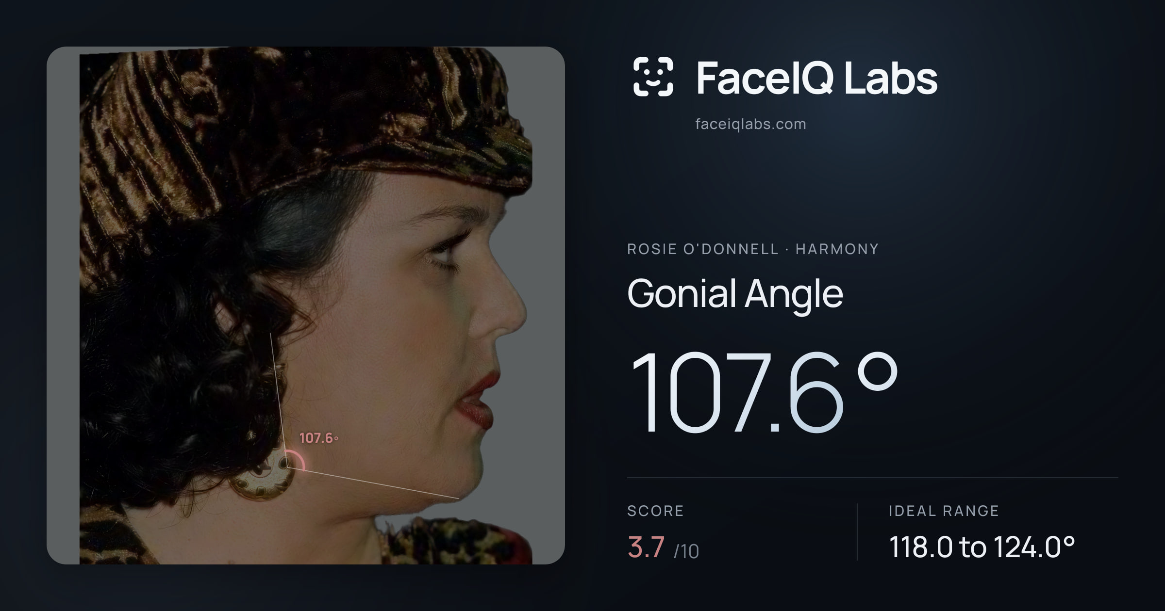Rosie O'Donnell Gonial Angle: 107.6°, drawn on the photo