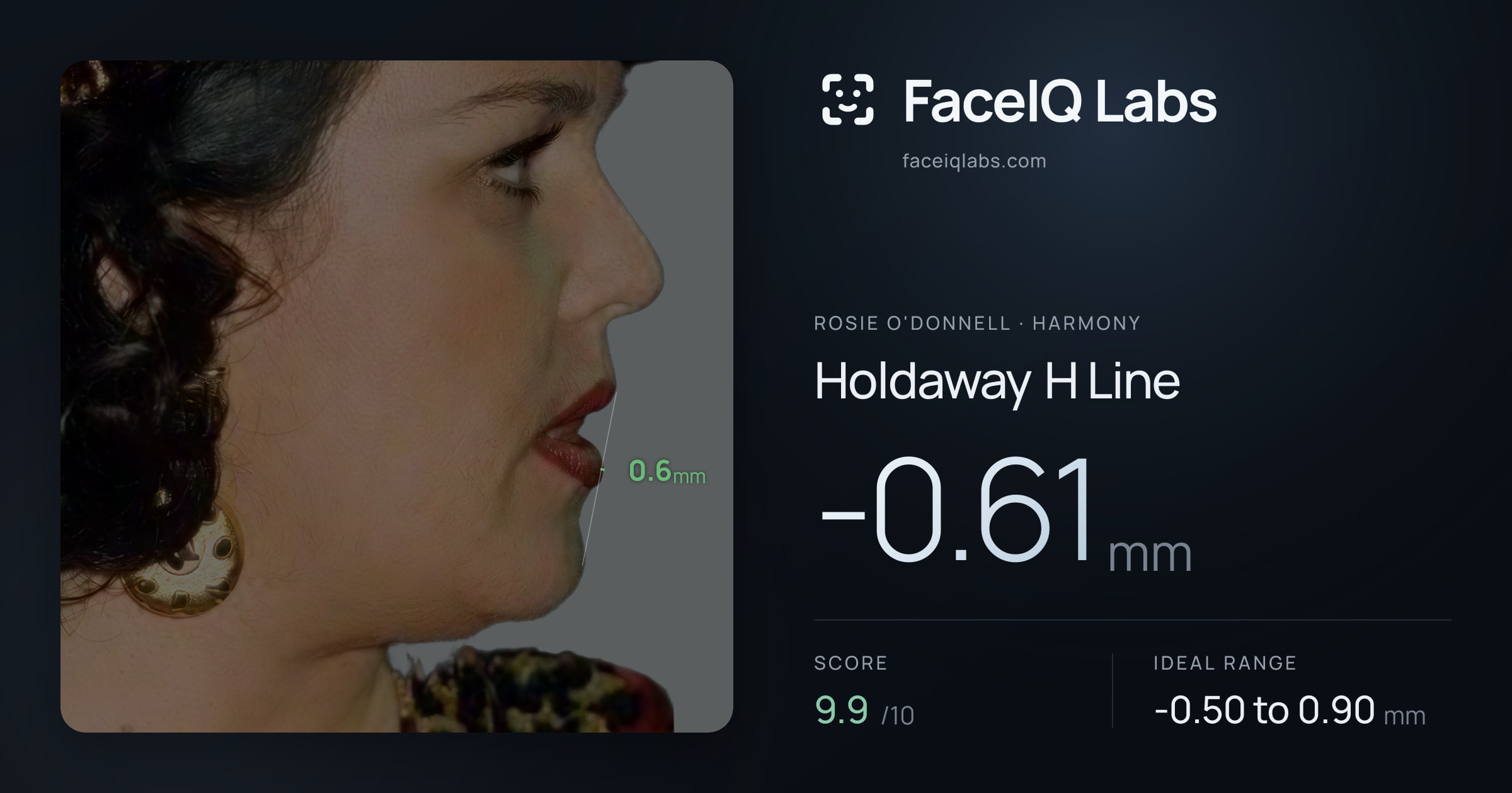 Rosie O'Donnell Holdaway H Line: -0.61mm, drawn on the photo