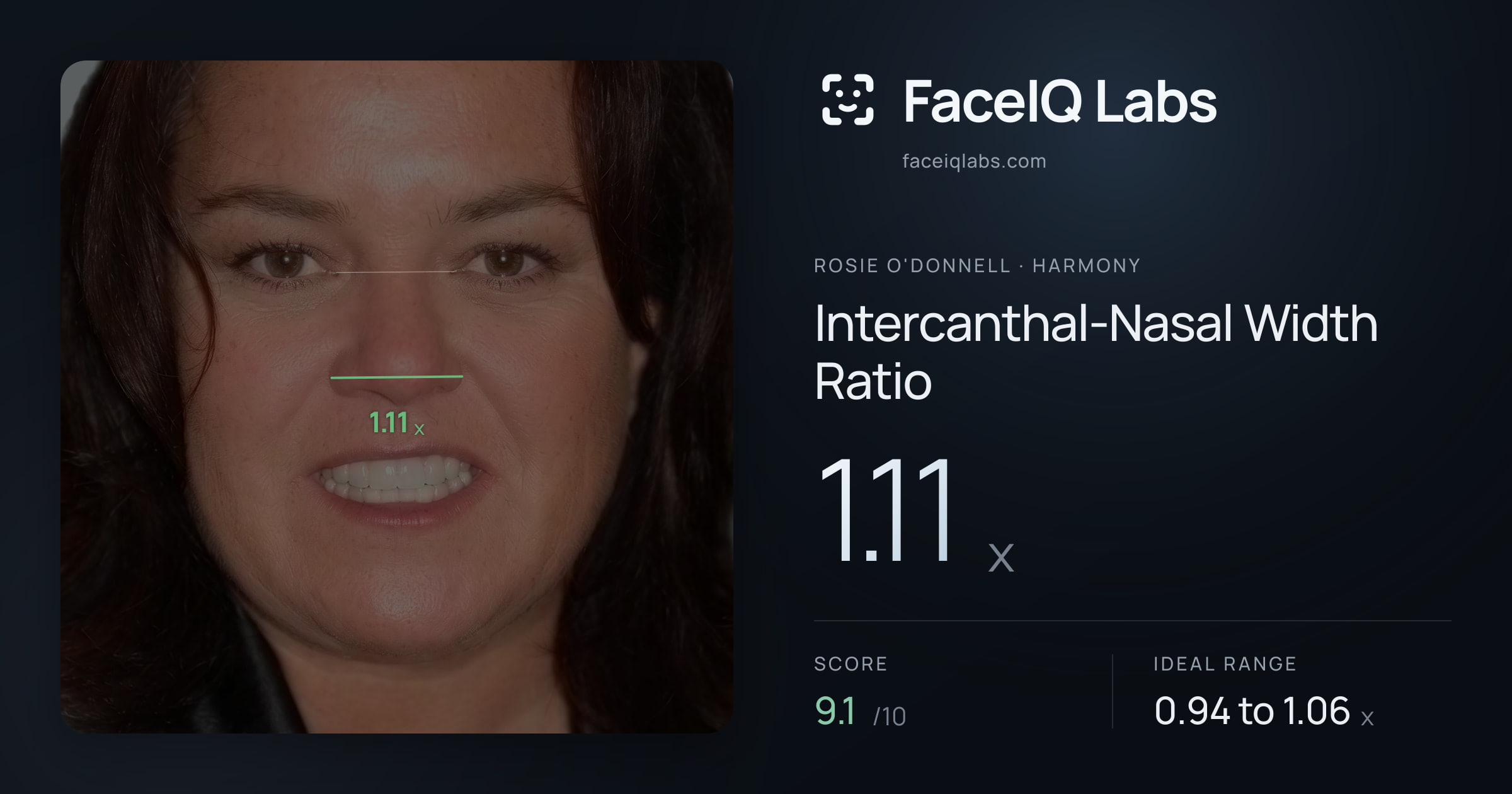 Rosie O'Donnell Intercanthal-Nasal Width Ratio: 1.11x, drawn on the photo