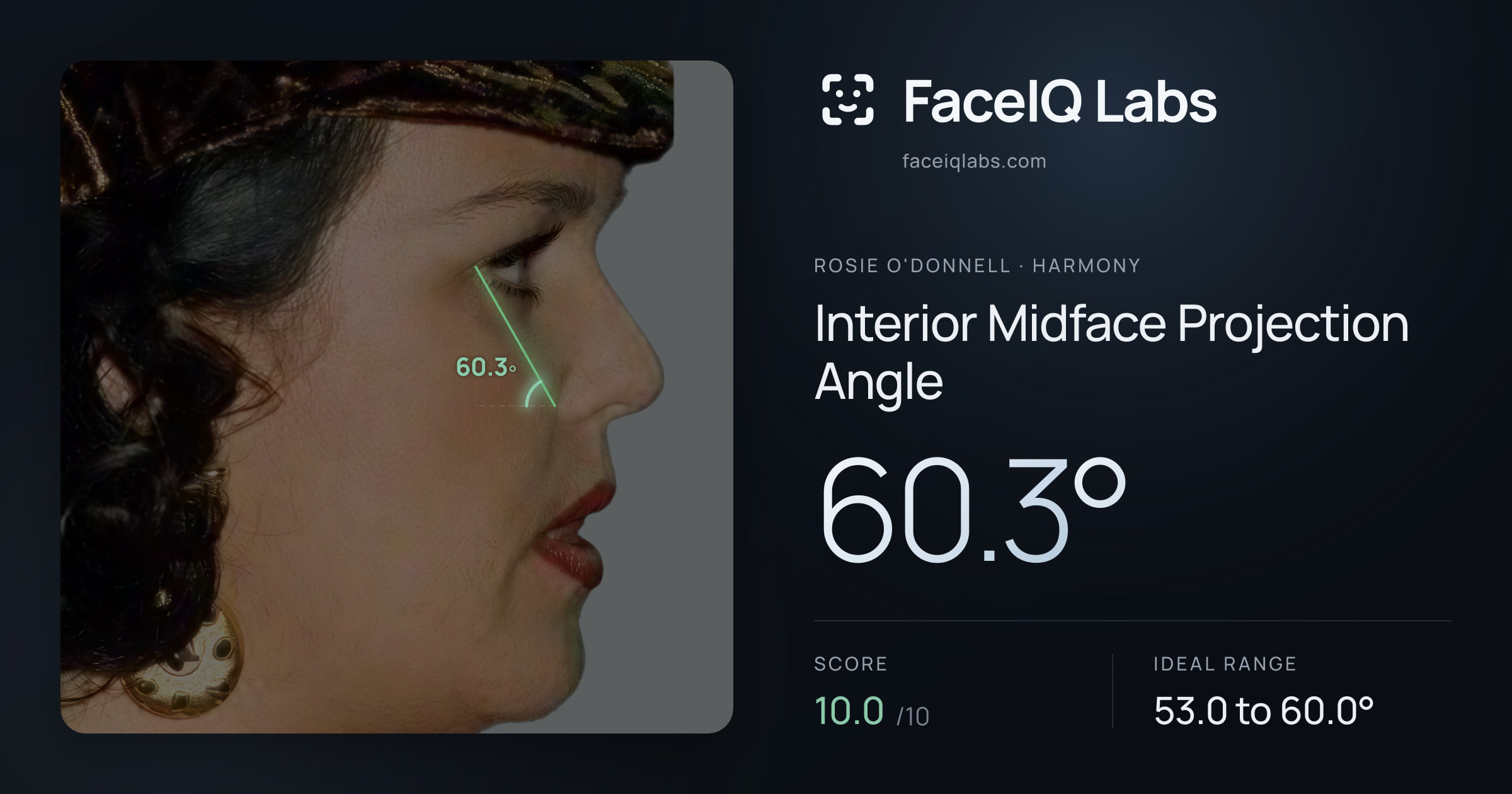Rosie O'Donnell Interior Midface Projection Angle: 60.3°, drawn on the photo