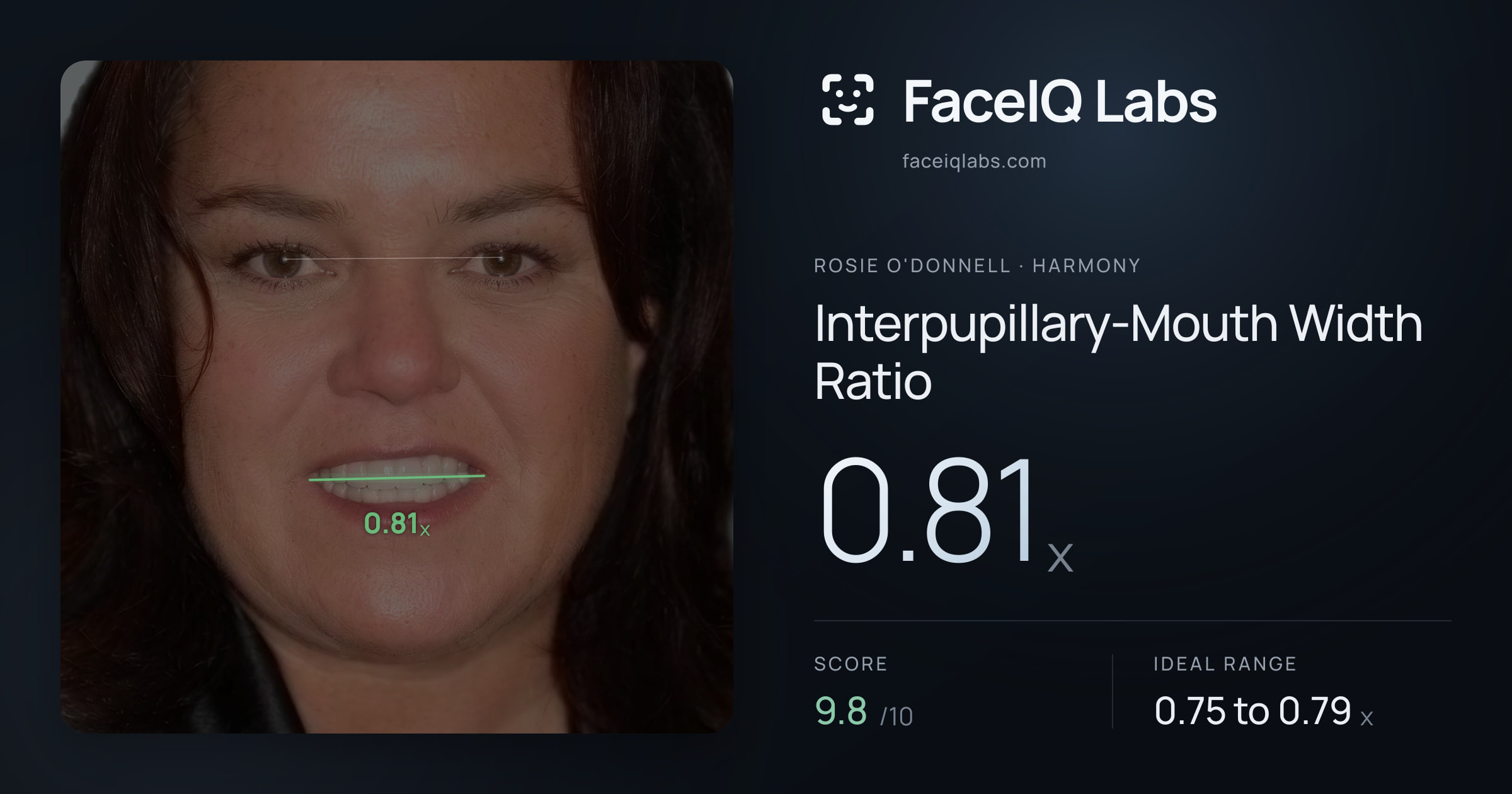 Rosie O'Donnell Interpupillary-Mouth Width Ratio: 0.81x, drawn on the photo