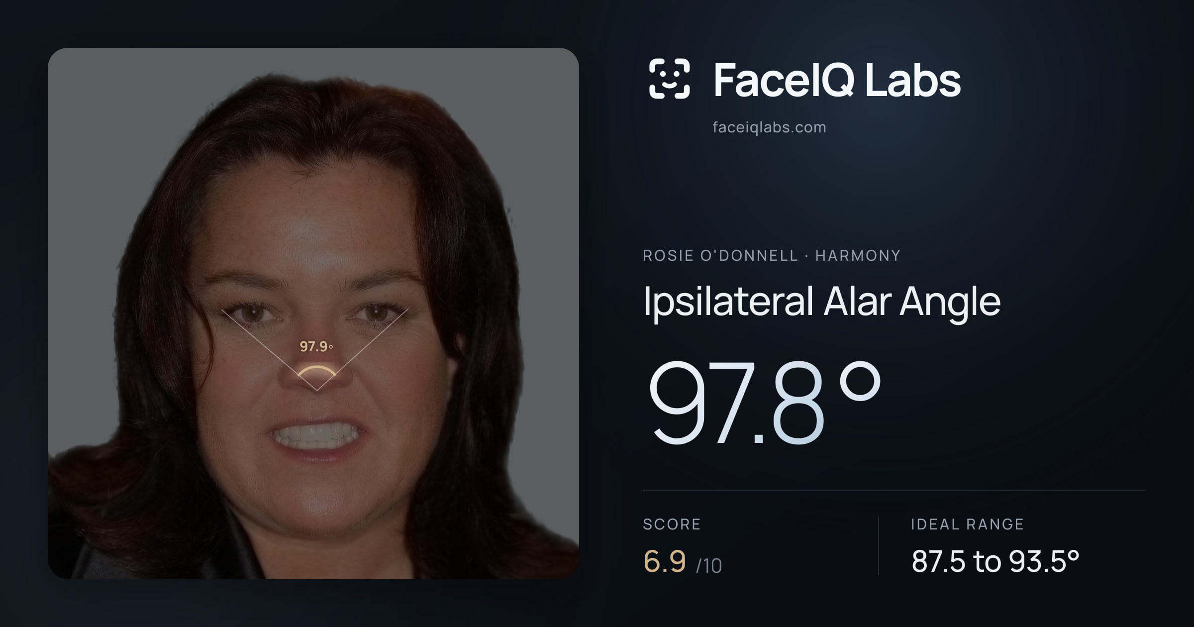 Rosie O'Donnell Ipsilateral Alar Angle: 97.8°, drawn on the photo