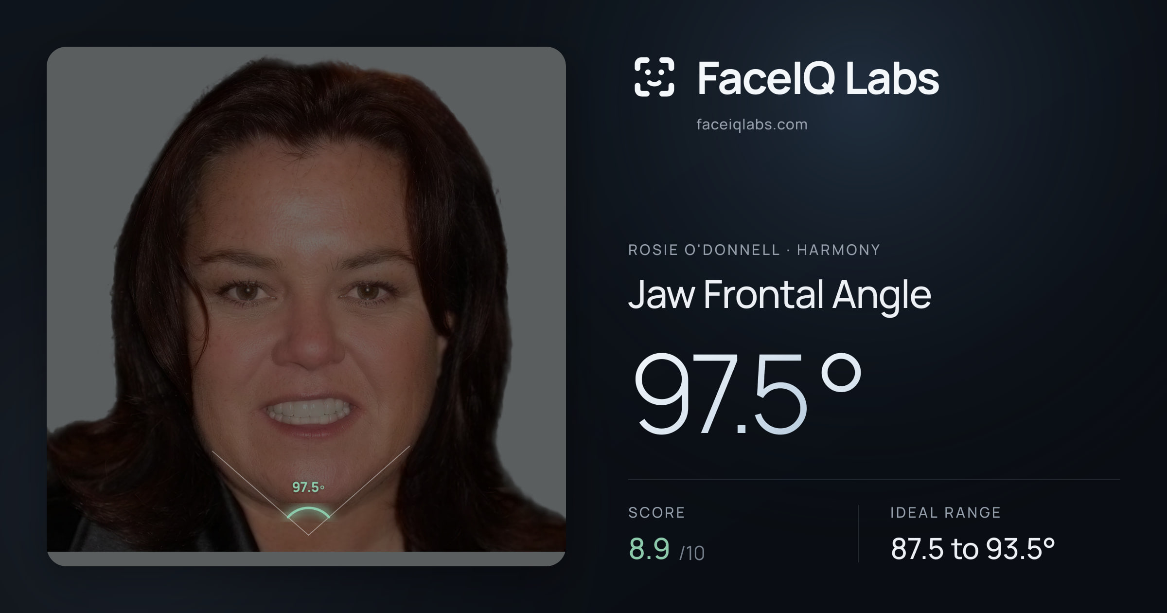 Rosie O'Donnell Jaw Frontal Angle: 97.5°, drawn on the photo