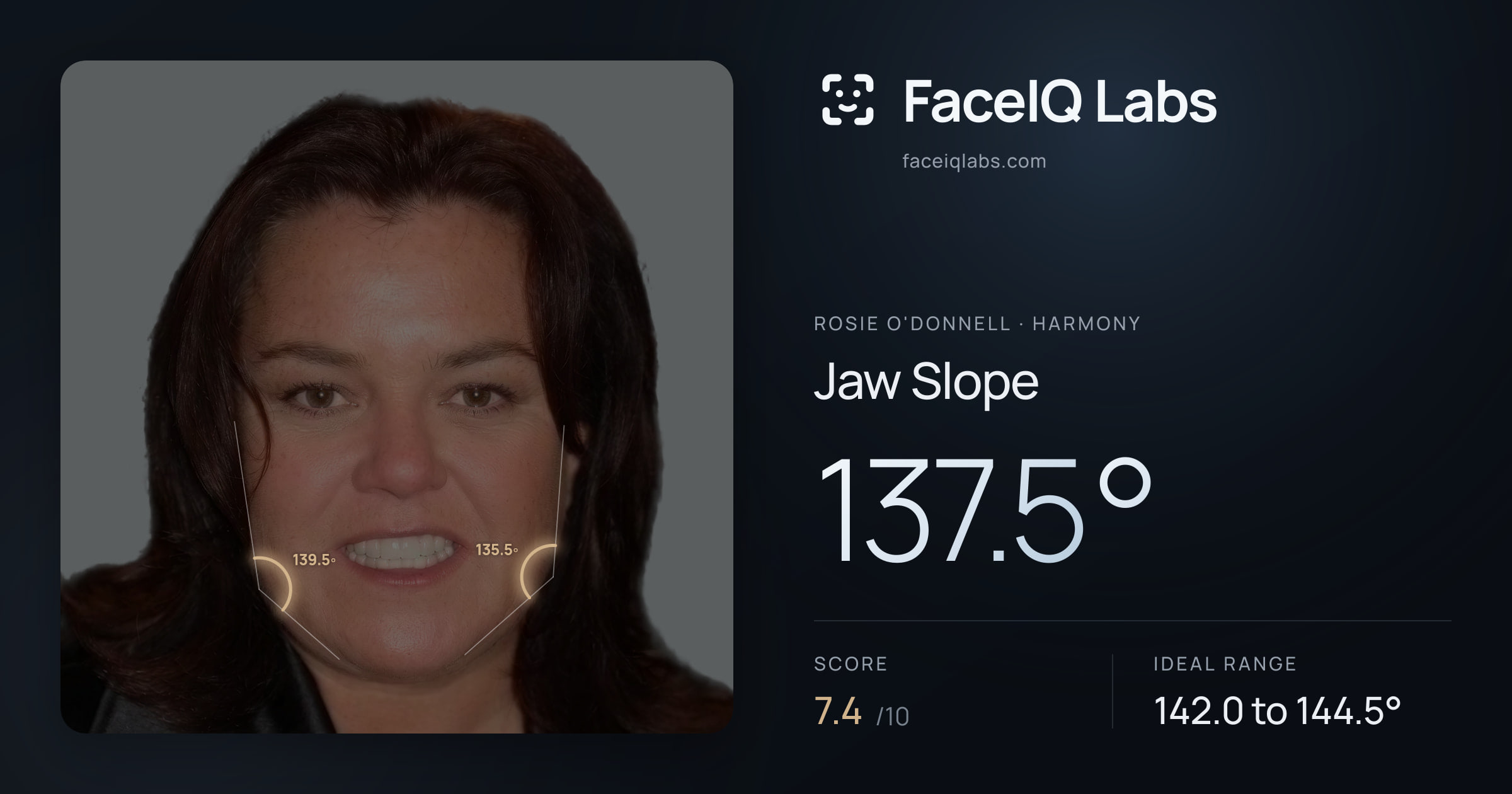 Rosie O'Donnell Jaw Slope: 137.5°, drawn on the photo