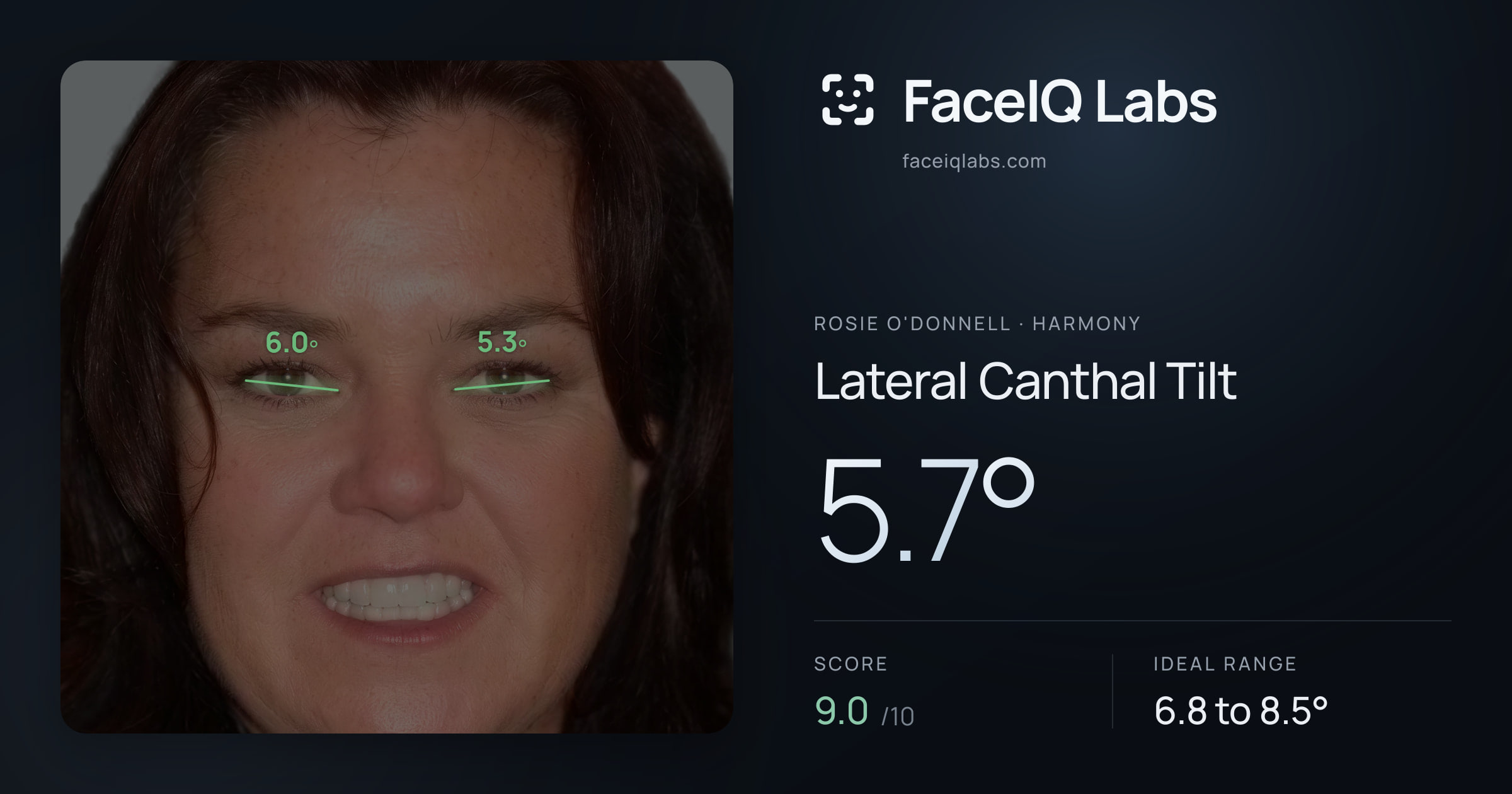 Rosie O'Donnell Lateral Canthal Tilt: 5.7°, drawn on the photo