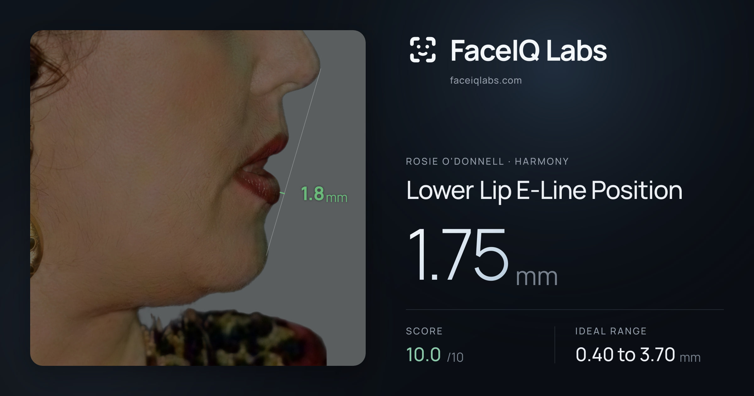 Rosie O'Donnell Lower Lip E-Line Position: 1.75mm, drawn on the photo