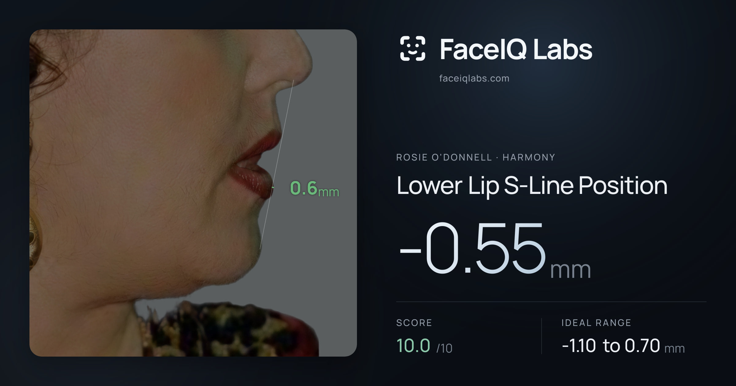 Rosie O'Donnell Lower Lip S-Line Position: -0.55mm, drawn on the photo