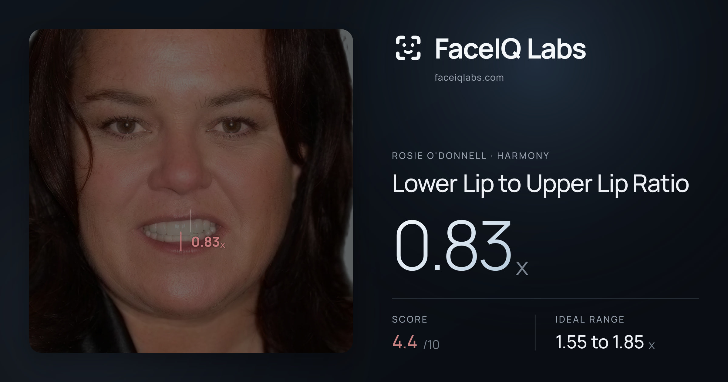 Rosie O'Donnell Lower Lip to Upper Lip Ratio: 0.83x, drawn on the photo