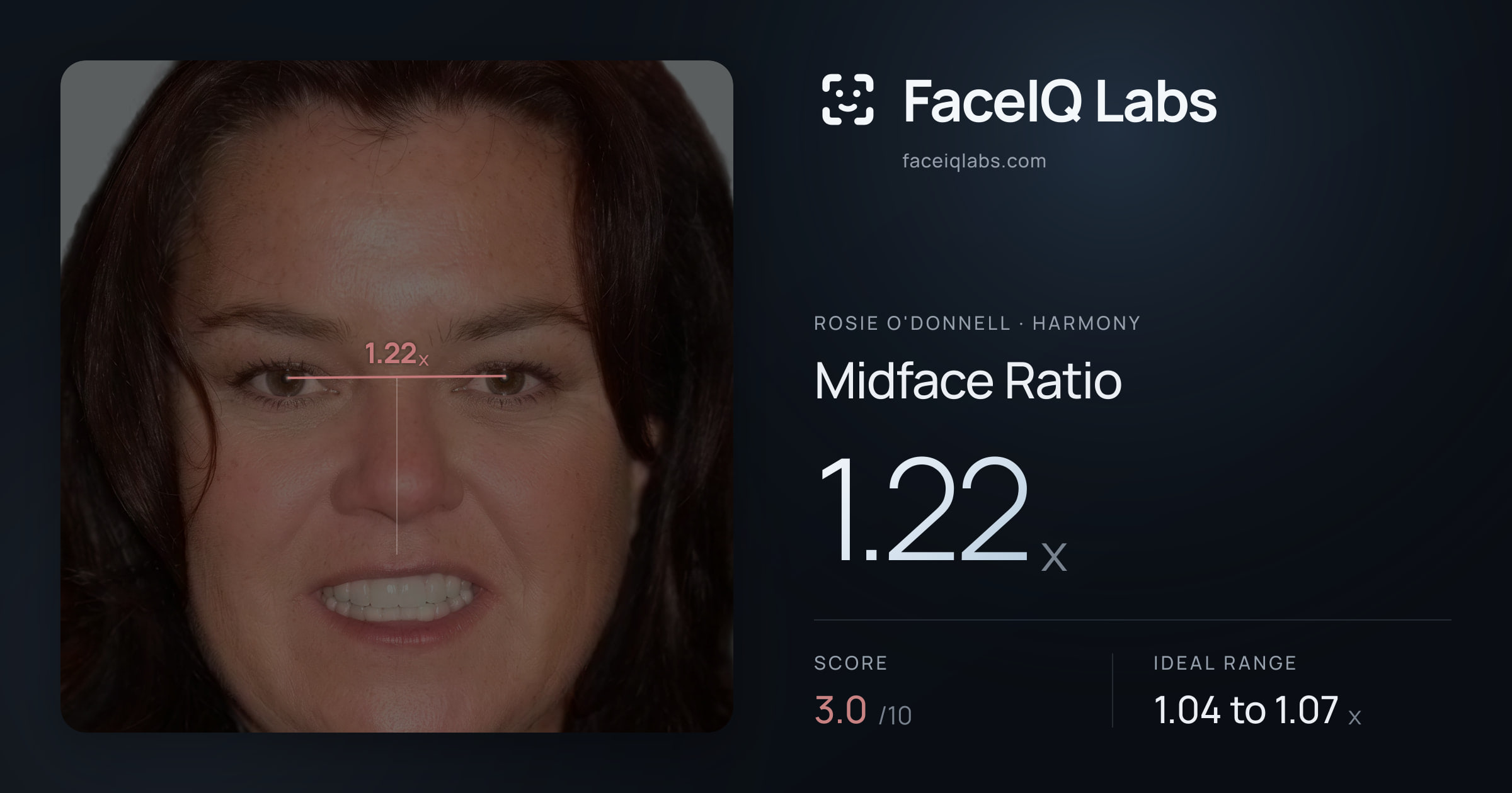 Rosie O'Donnell Midface Ratio: 1.22x, drawn on the photo
