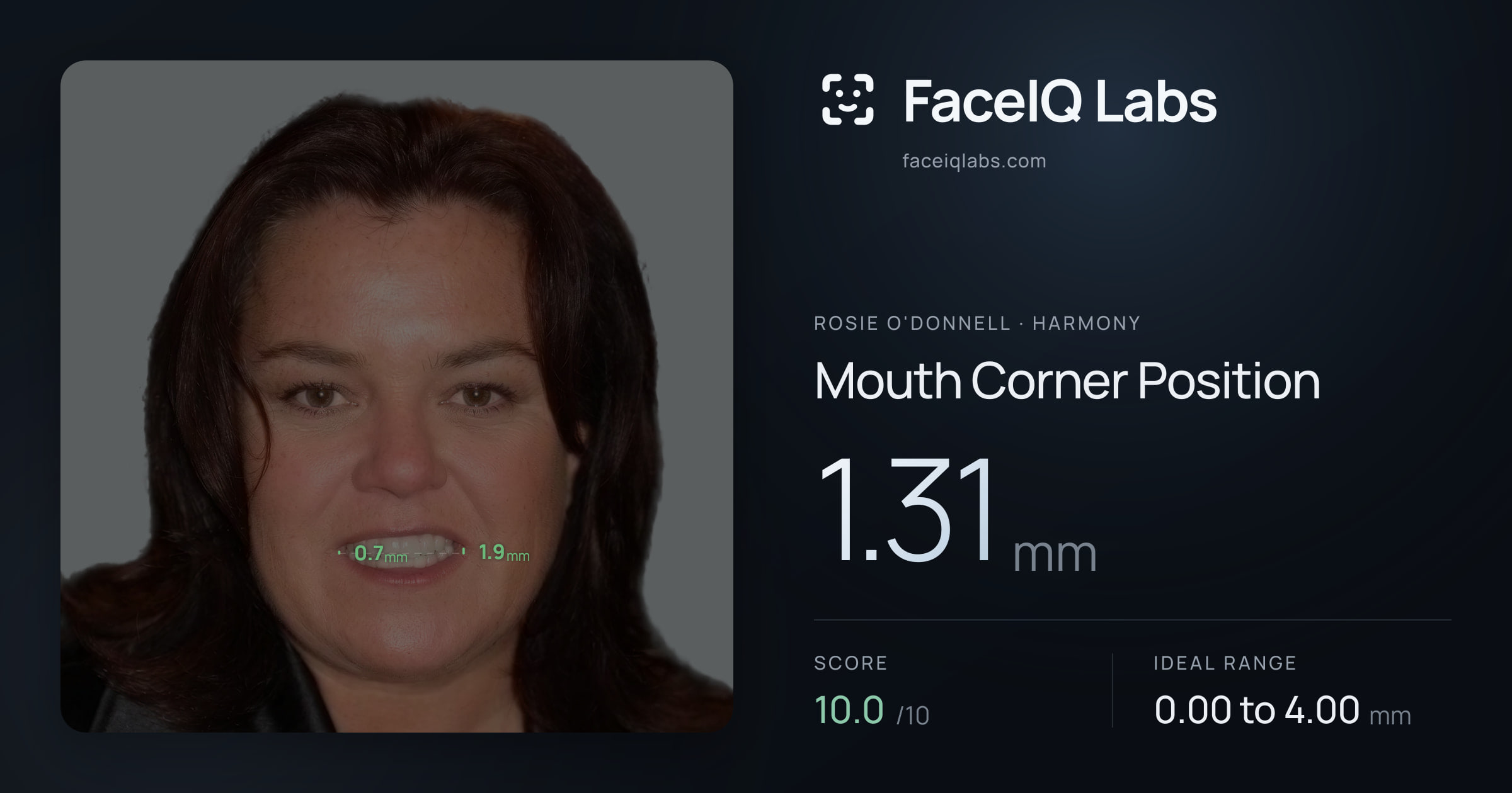 Rosie O'Donnell Mouth Corner Position: 1.31mm, drawn on the photo