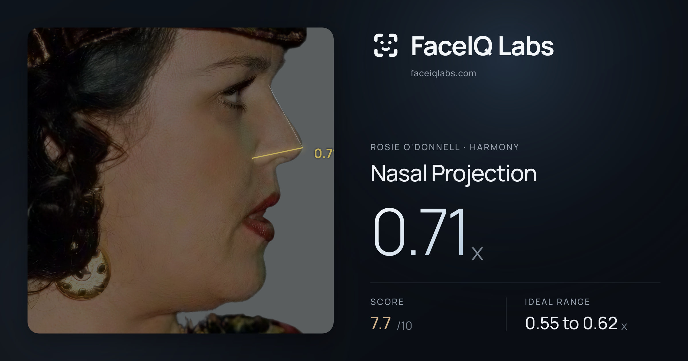 Rosie O'Donnell Nasal Projection: 0.71x, drawn on the photo