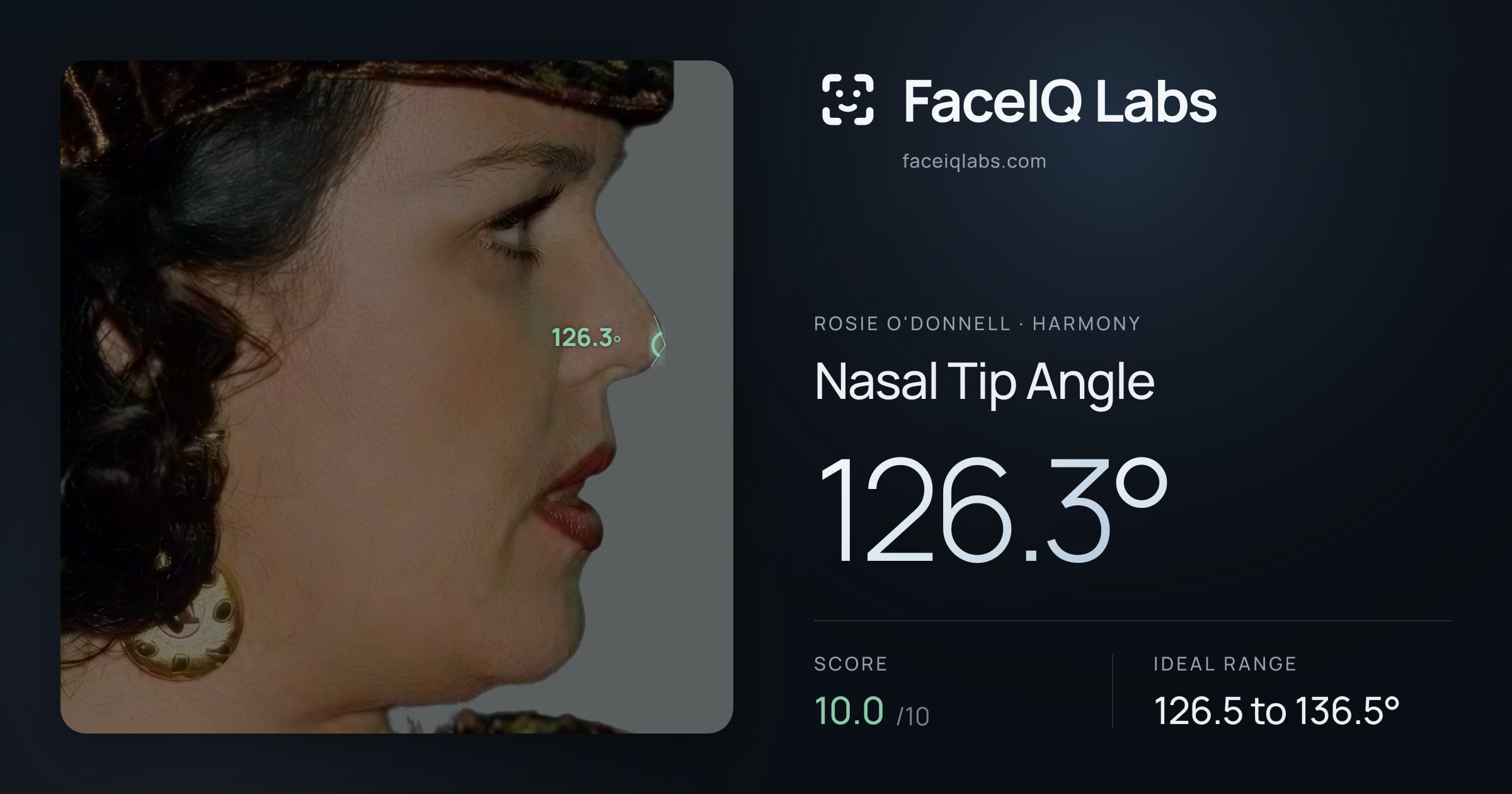 Rosie O'Donnell Nasal Tip Angle: 126.3°, drawn on the photo