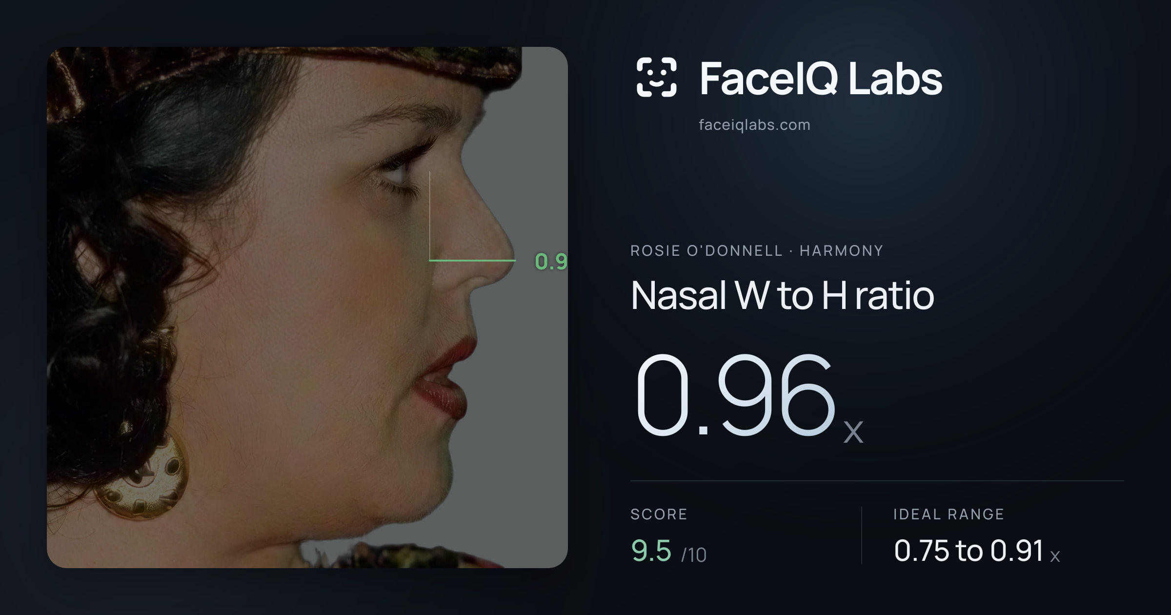 Rosie O'Donnell Nasal W to H ratio: 0.96x, drawn on the photo