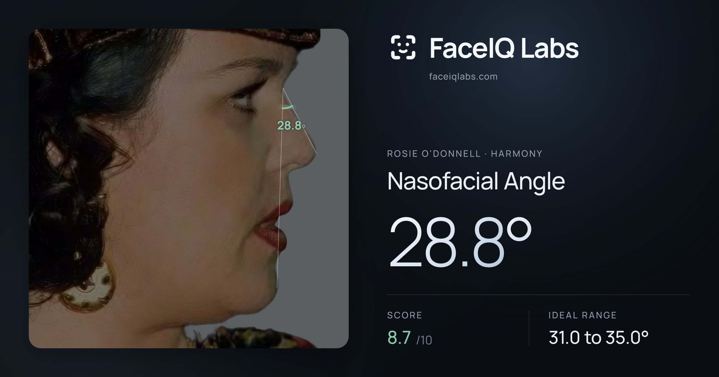 Rosie O'Donnell Nasofacial Angle: 28.8°, drawn on the photo