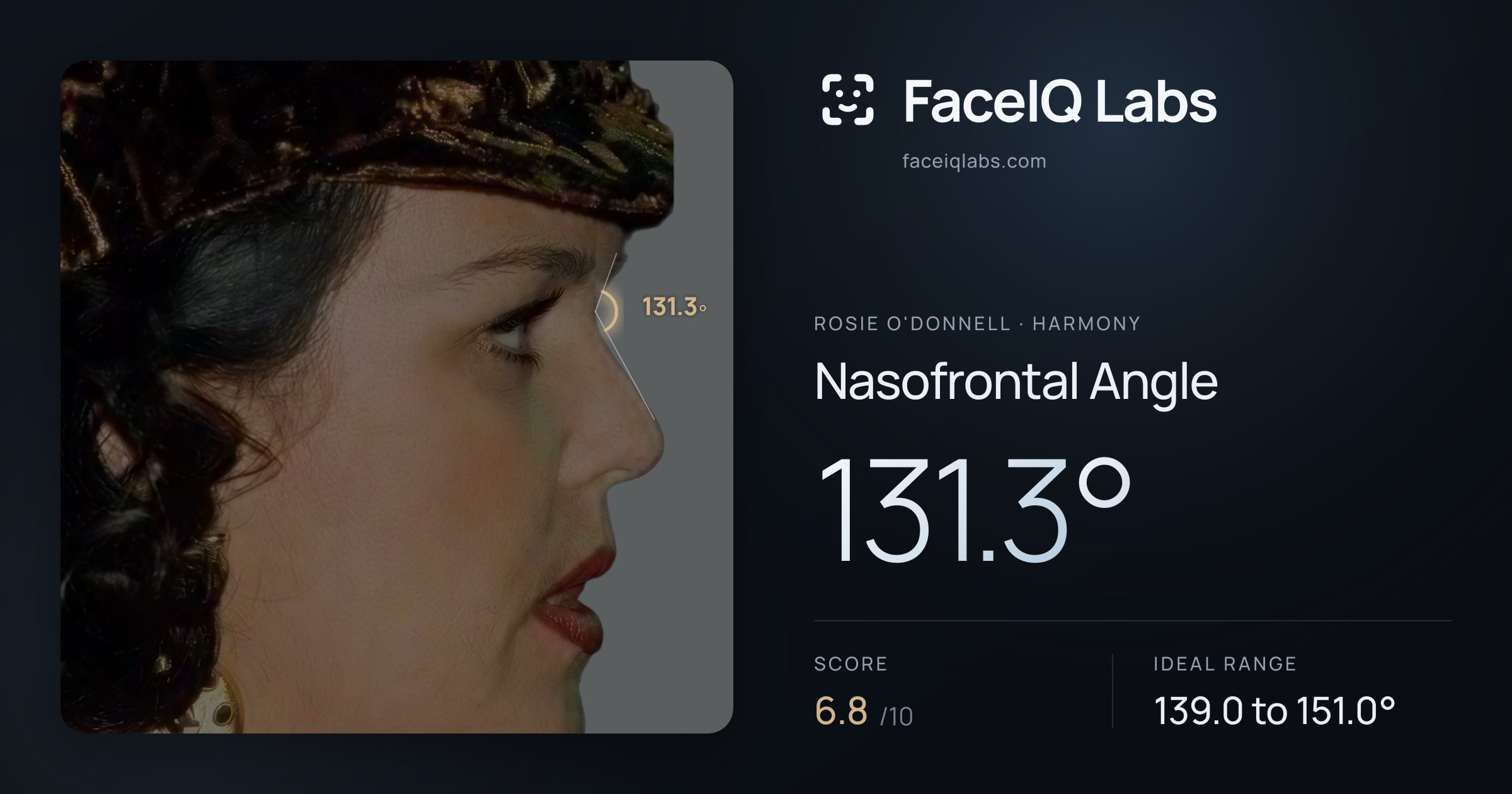 Rosie O'Donnell Nasofrontal Angle: 131.3°, drawn on the photo