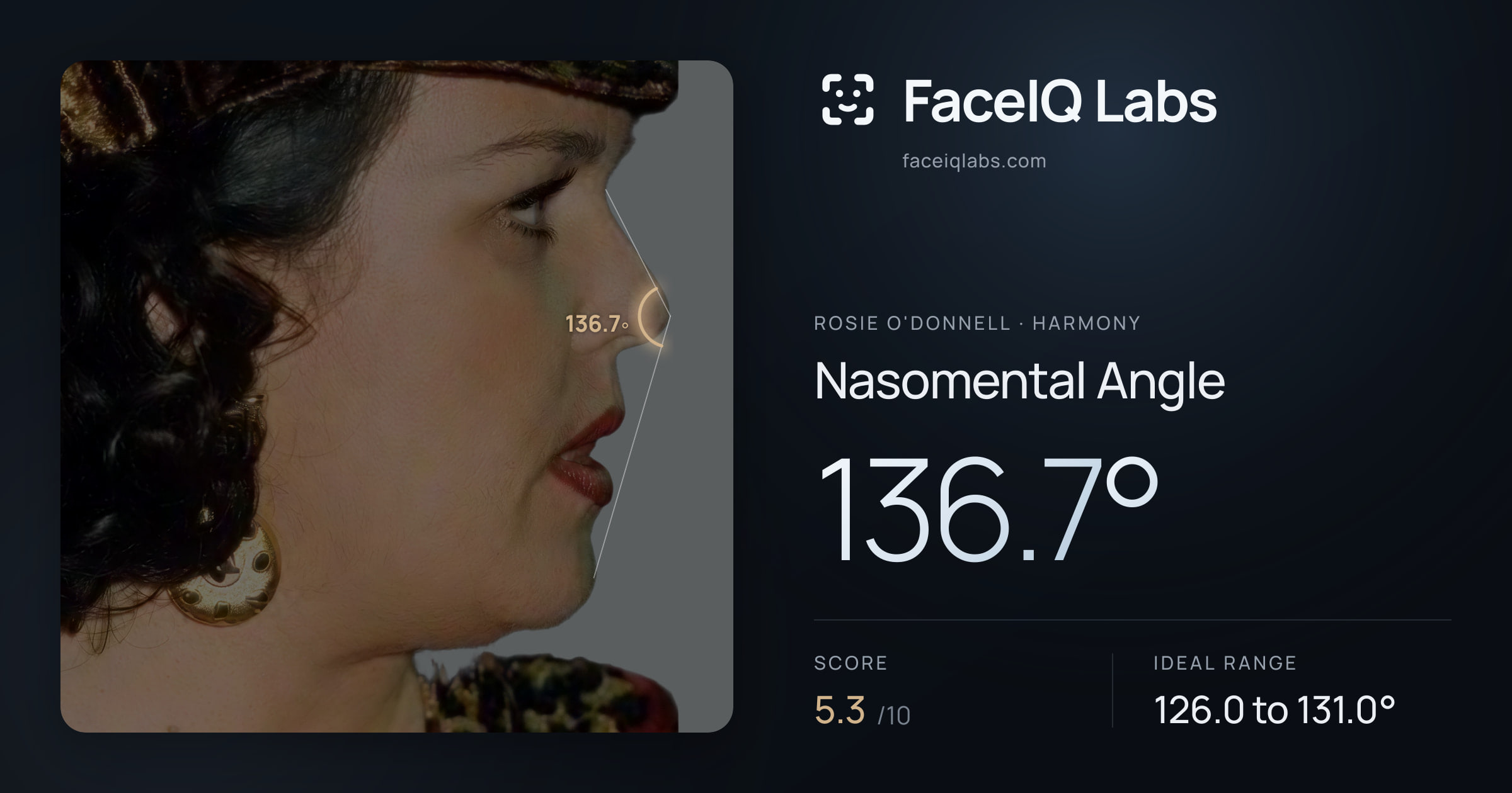 Rosie O'Donnell Nasomental Angle: 136.7°, drawn on the photo