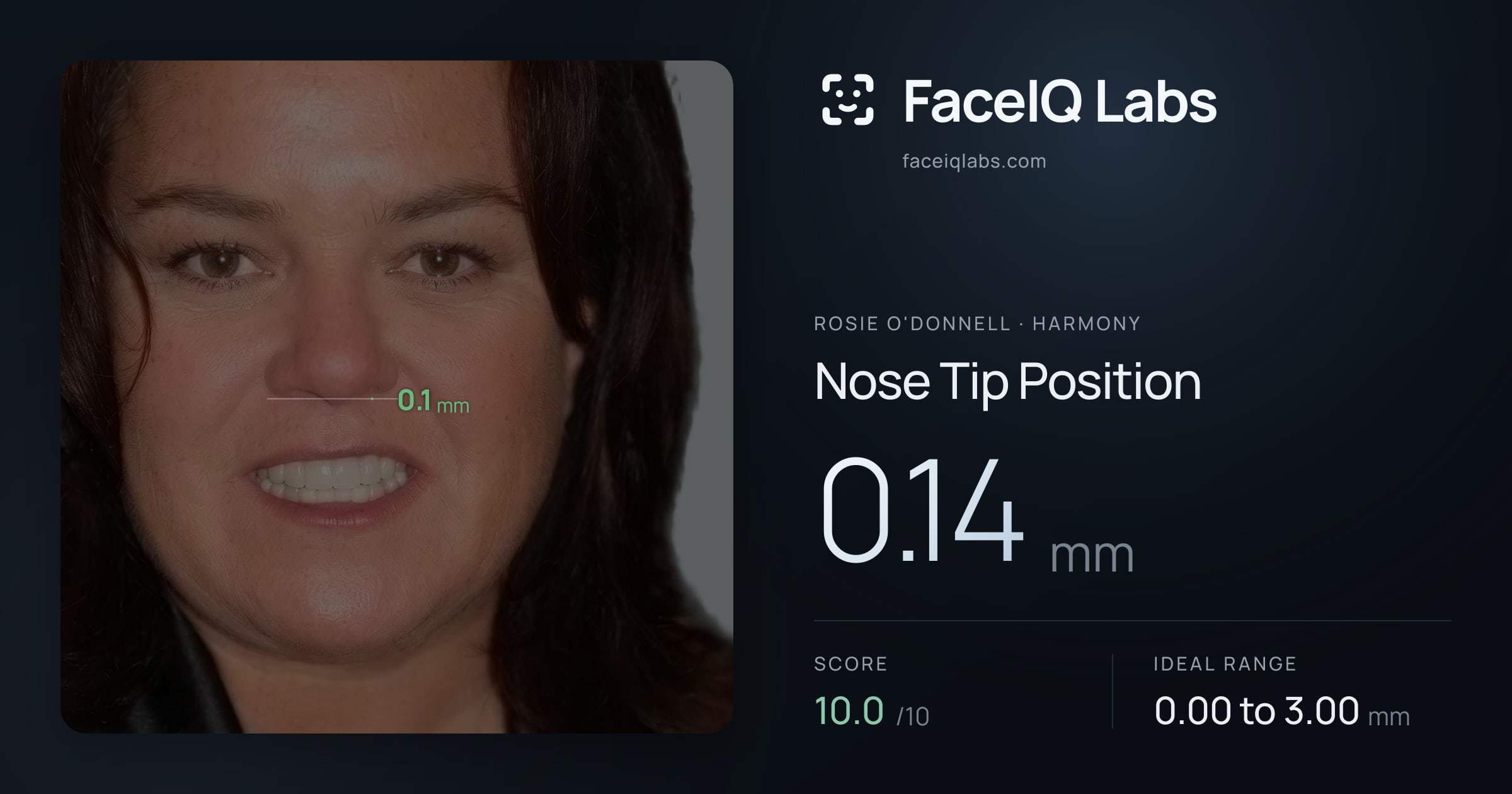 Rosie O'Donnell Nose Tip Position: 0.14mm, drawn on the photo
