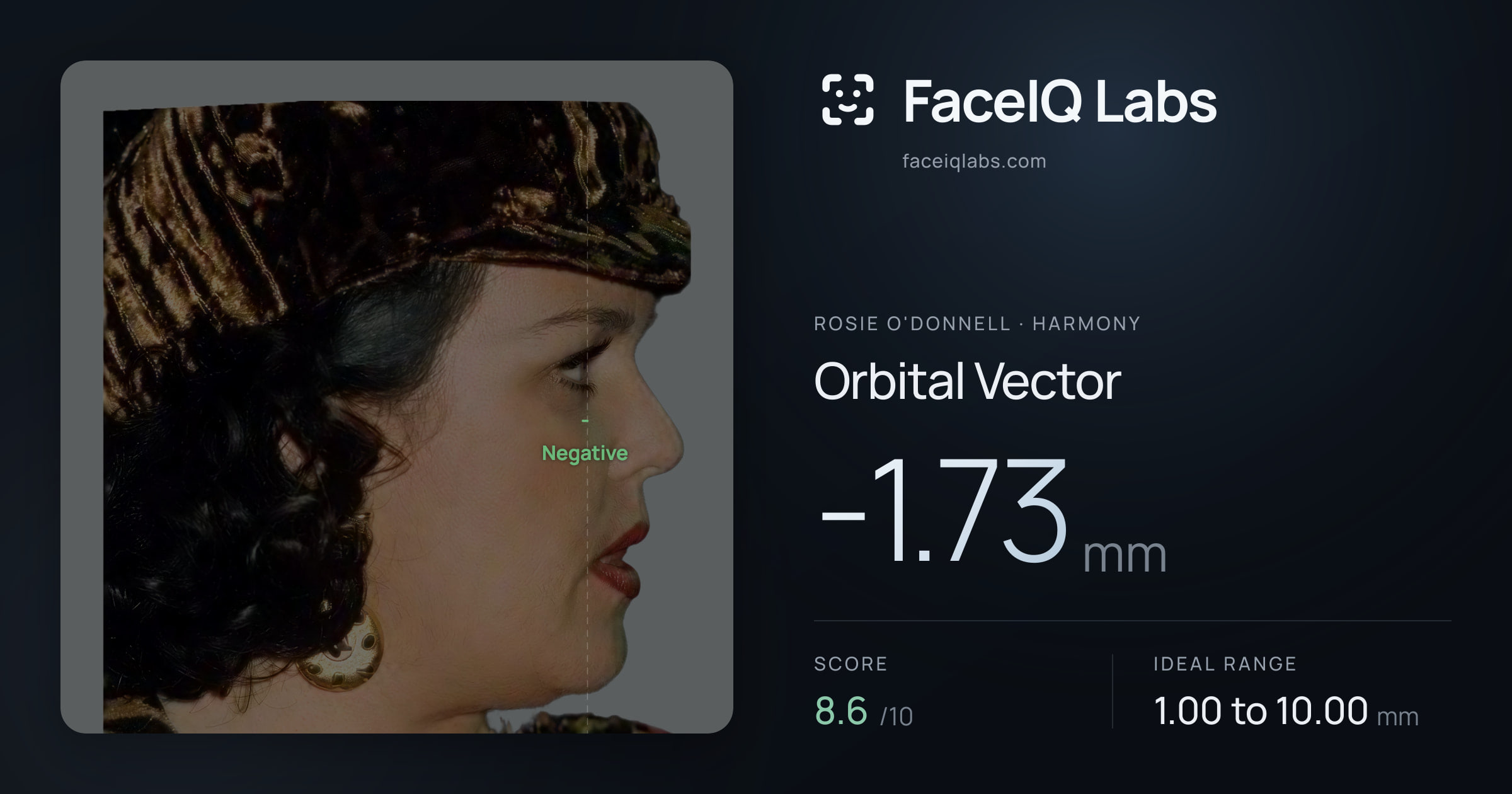 Rosie O'Donnell Orbital Vector: -1.73mm, drawn on the photo