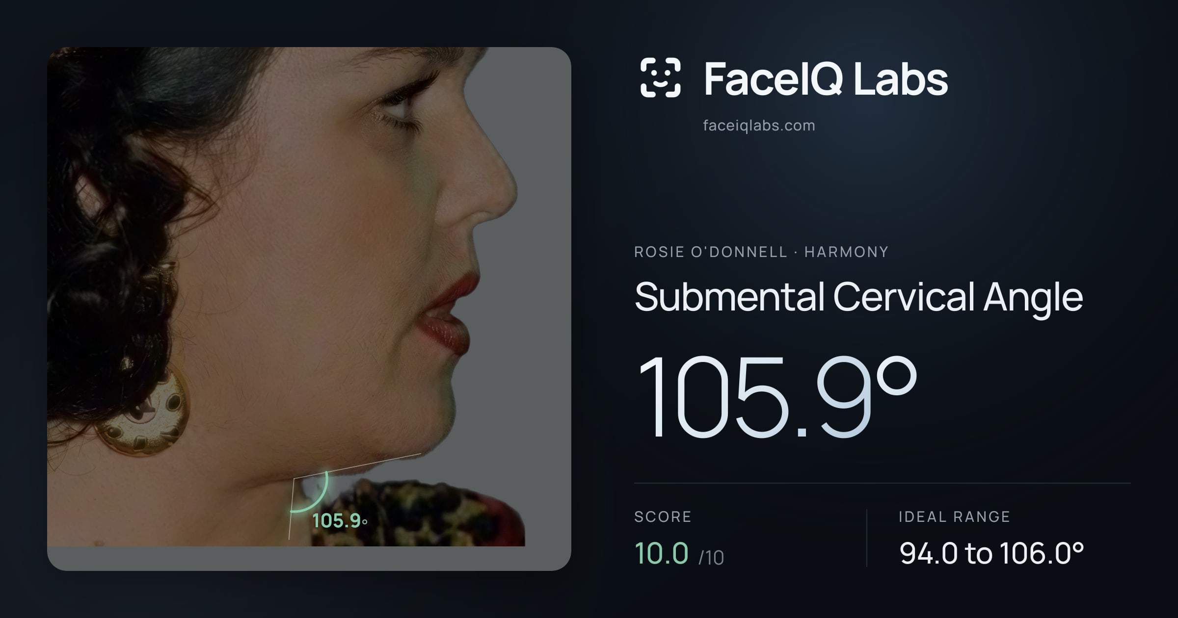 Rosie O'Donnell Submental Cervical Angle: 105.9°, drawn on the photo