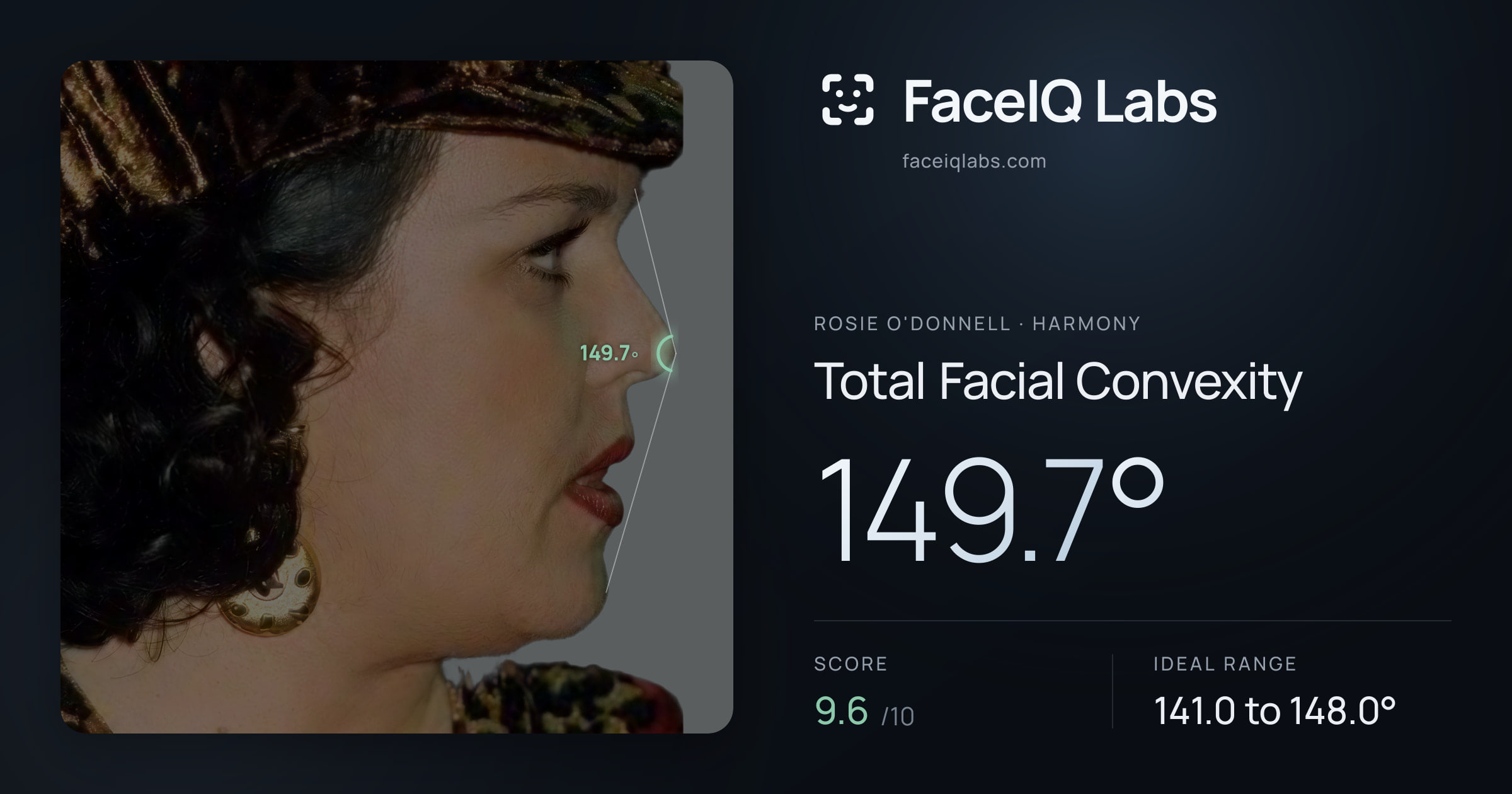 Rosie O'Donnell Total Facial Convexity: 149.7°, drawn on the photo