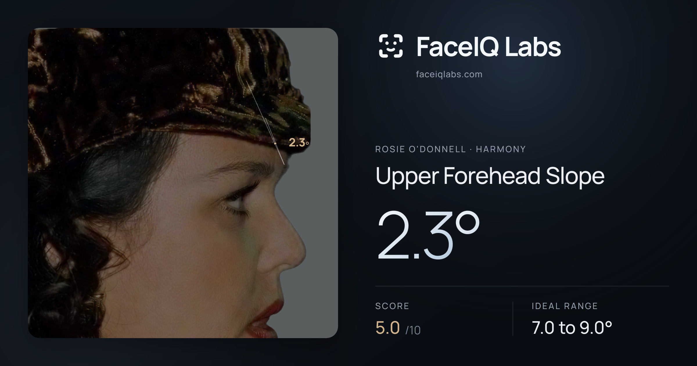 Rosie O'Donnell Upper Forehead Slope: 2.3°, drawn on the photo