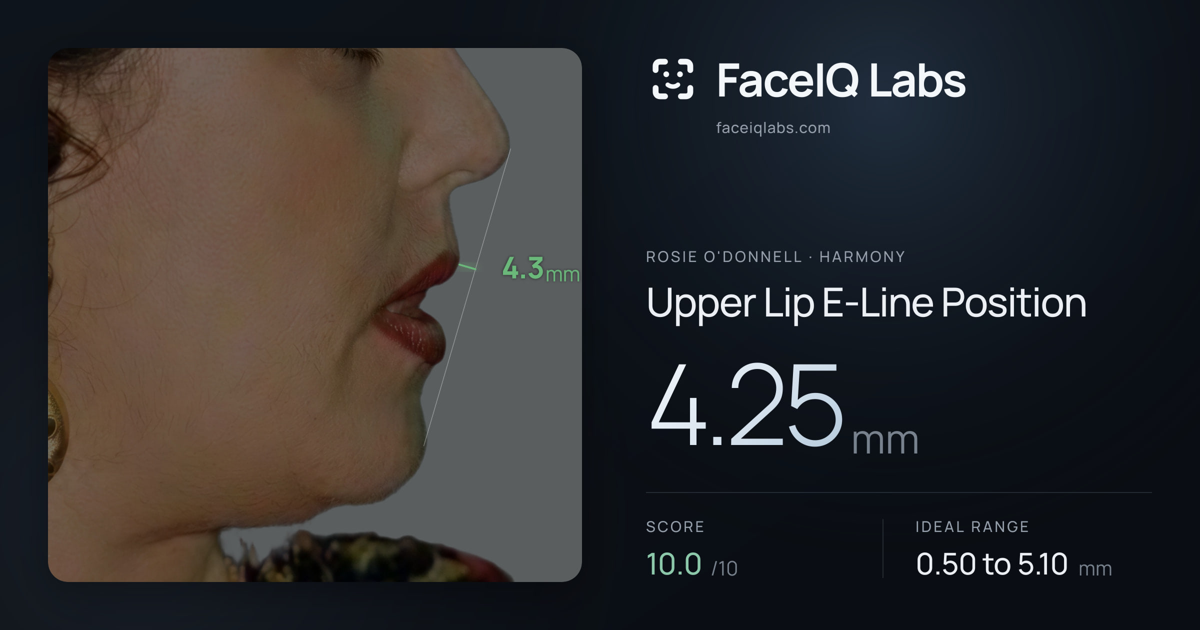 Rosie O'Donnell Upper Lip E-Line Position: 4.25mm, drawn on the photo