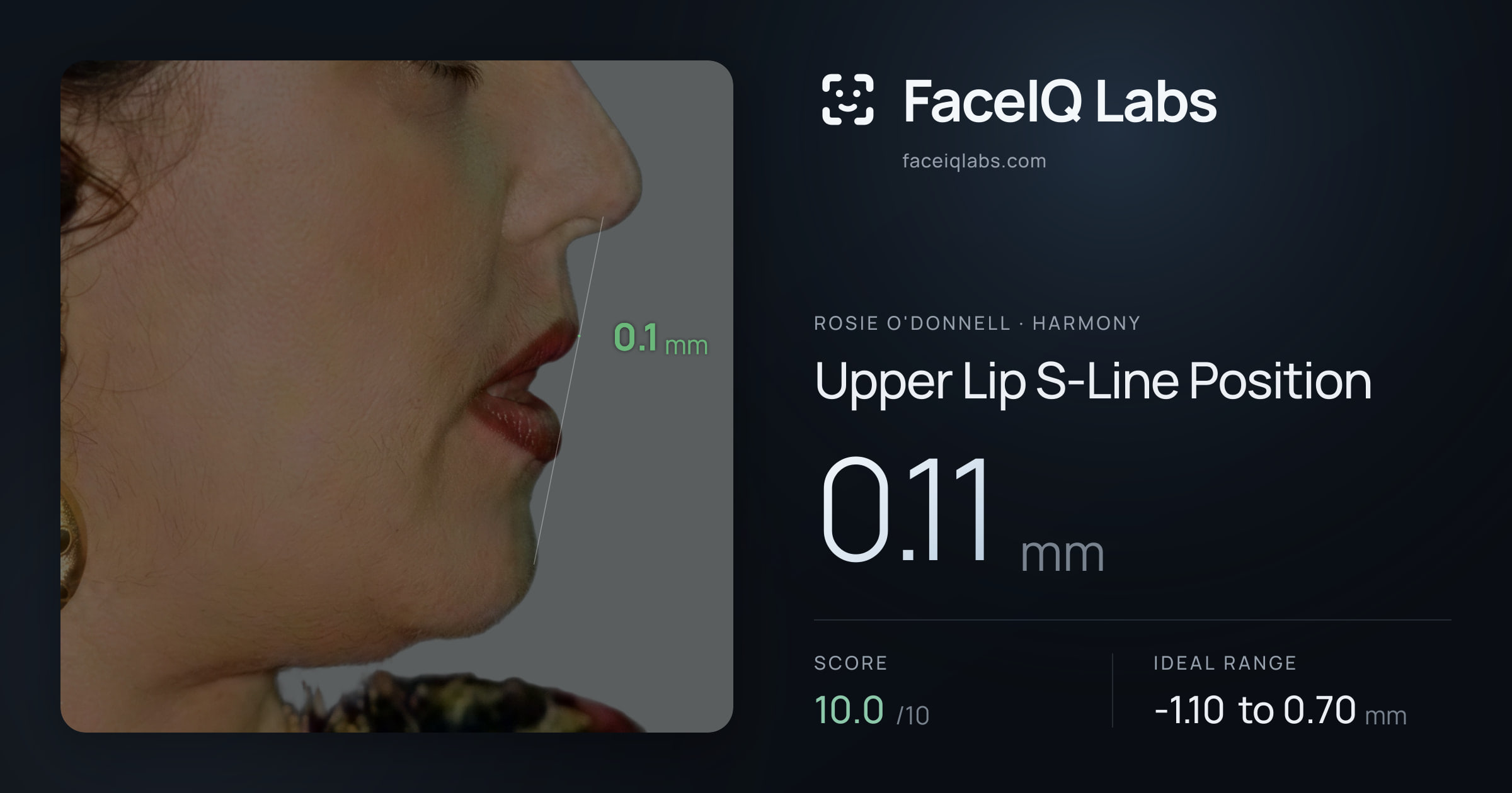 Rosie O'Donnell Upper Lip S-Line Position: 0.11mm, drawn on the photo