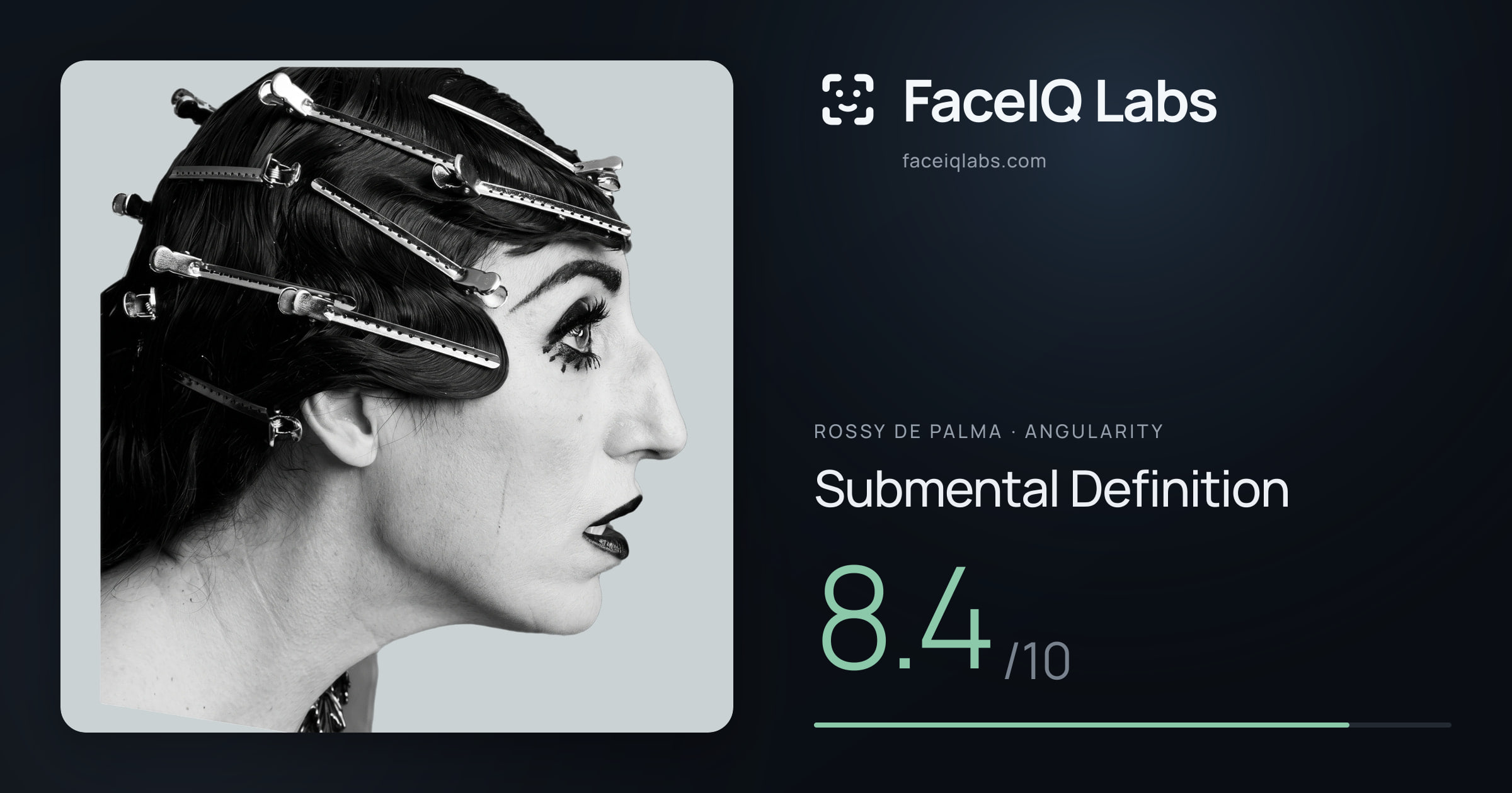 Rossy De Palma Submental Definition: 8.4/10, drawn on the photo