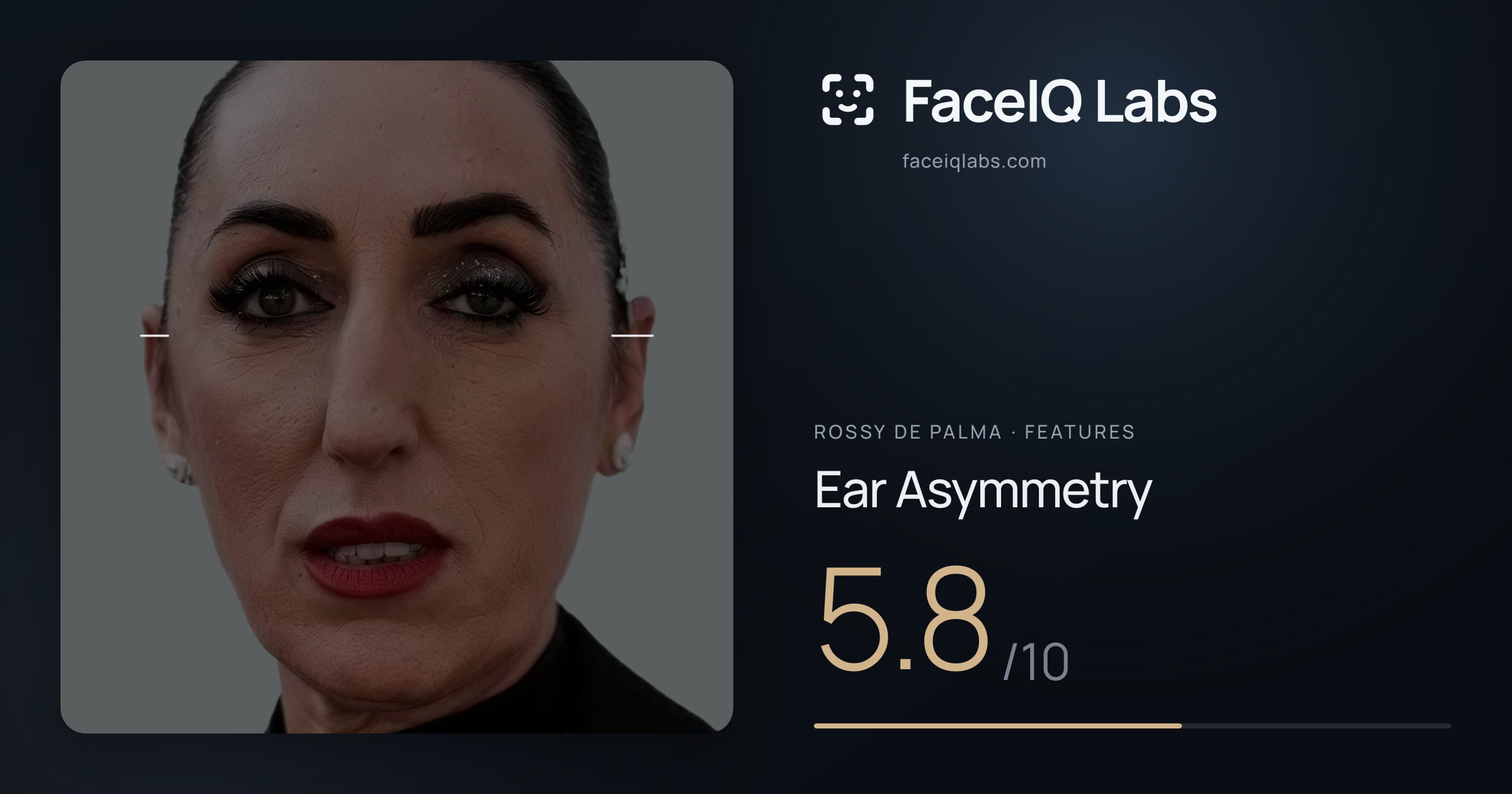 Rossy De Palma Ear Asymmetry: 5.8/10, drawn on the photo