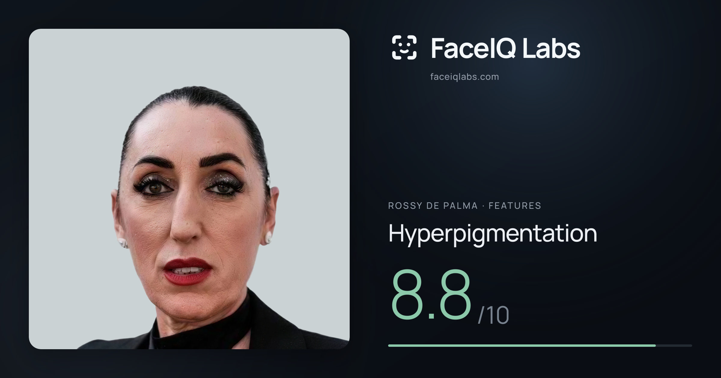 Rossy De Palma Hyperpigmentation: 8.8/10, drawn on the photo